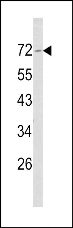 Western blot analysis of Merlin Antibody in NCI-H460 cell line lysates (35ug/lane)