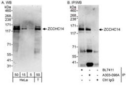 Detection of human ZCCHC14 by western blot and immunoprecipitation.