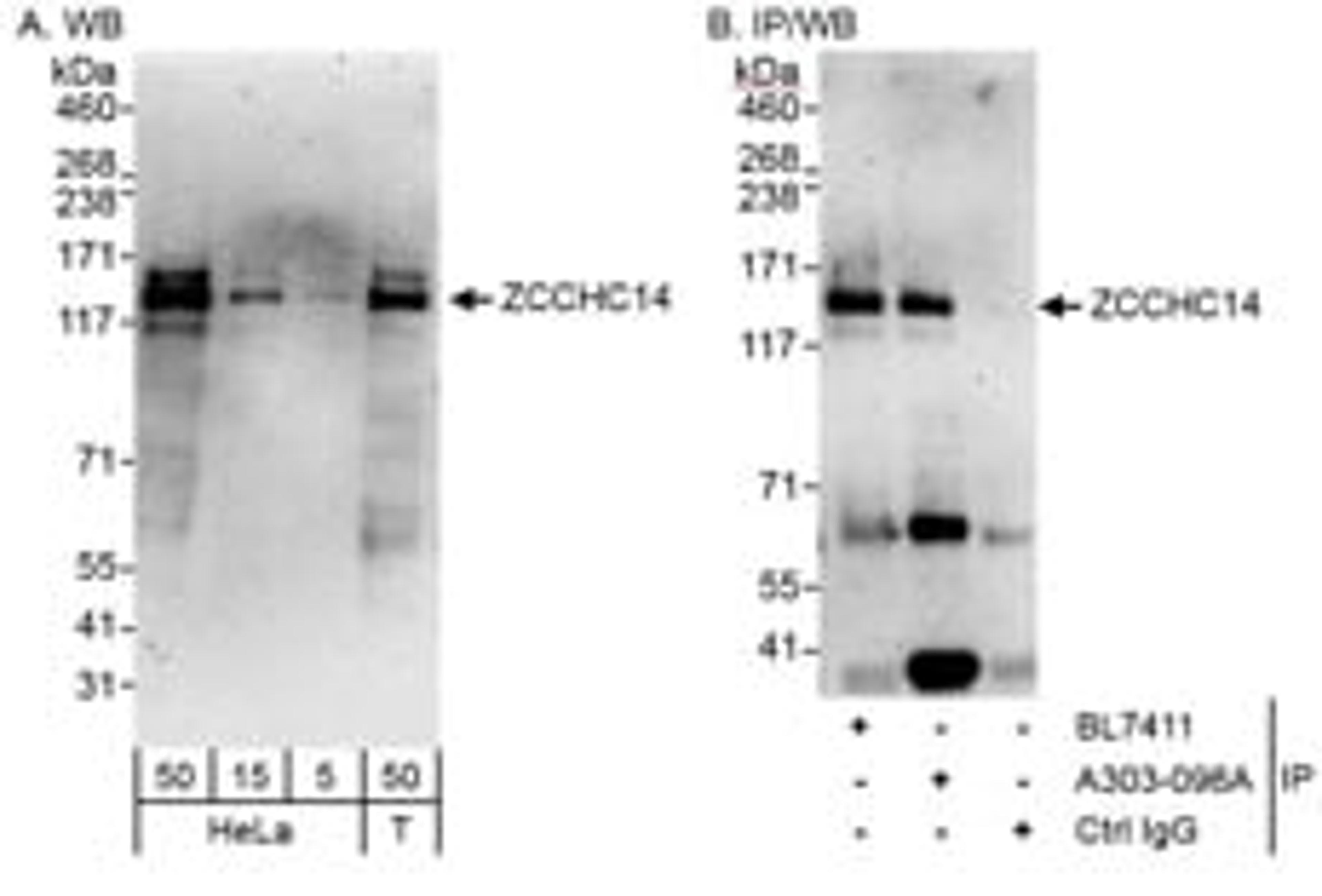 Detection of human ZCCHC14 by western blot and immunoprecipitation.