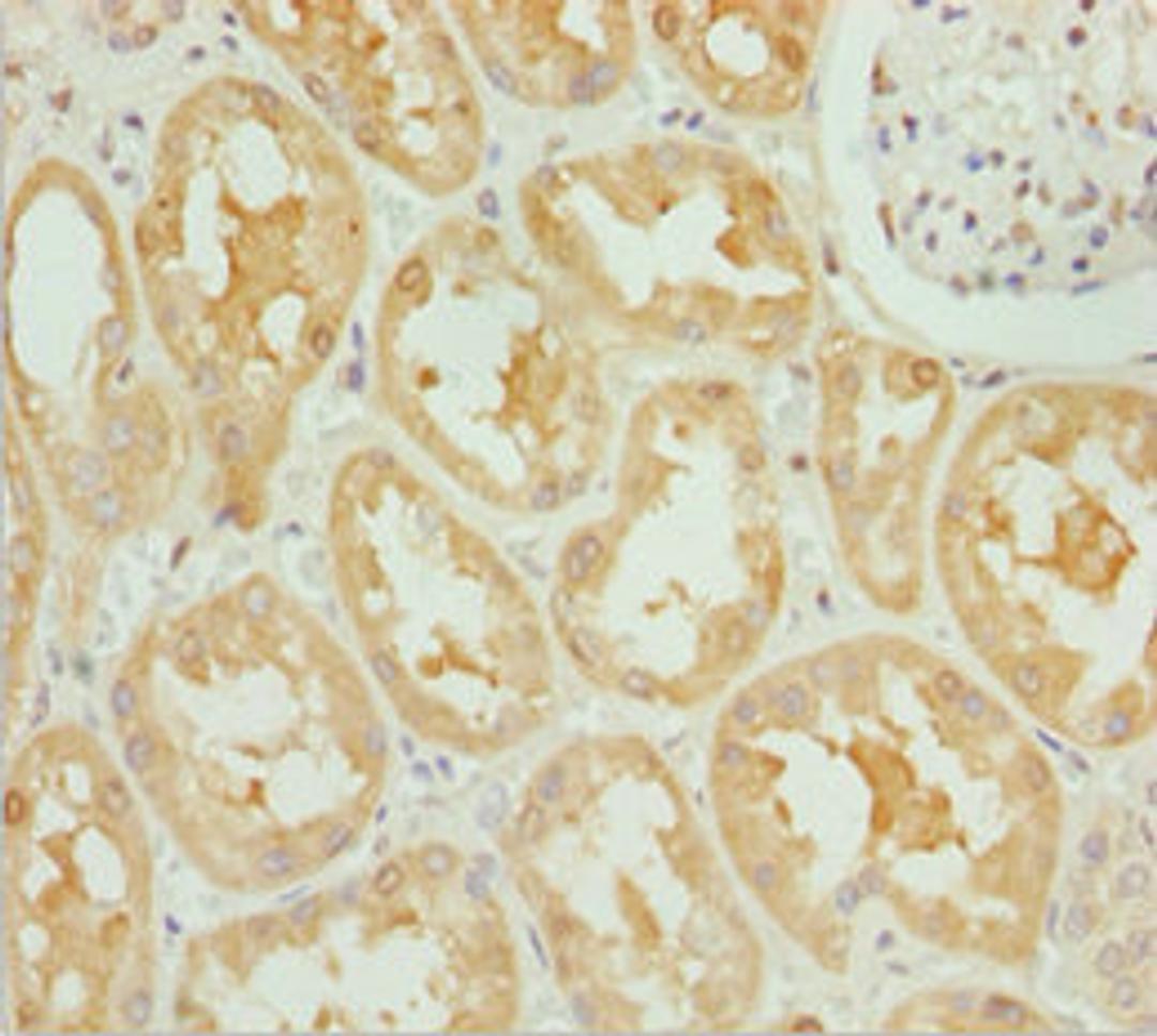 Immunohistochemistry of paraffin-embedded human kidney tissue using CSB-PA880985ESR1HU at dilution of 1:100