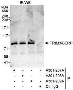 Detection of human TRIM3/BERP by western blot of immunoprecipitates.