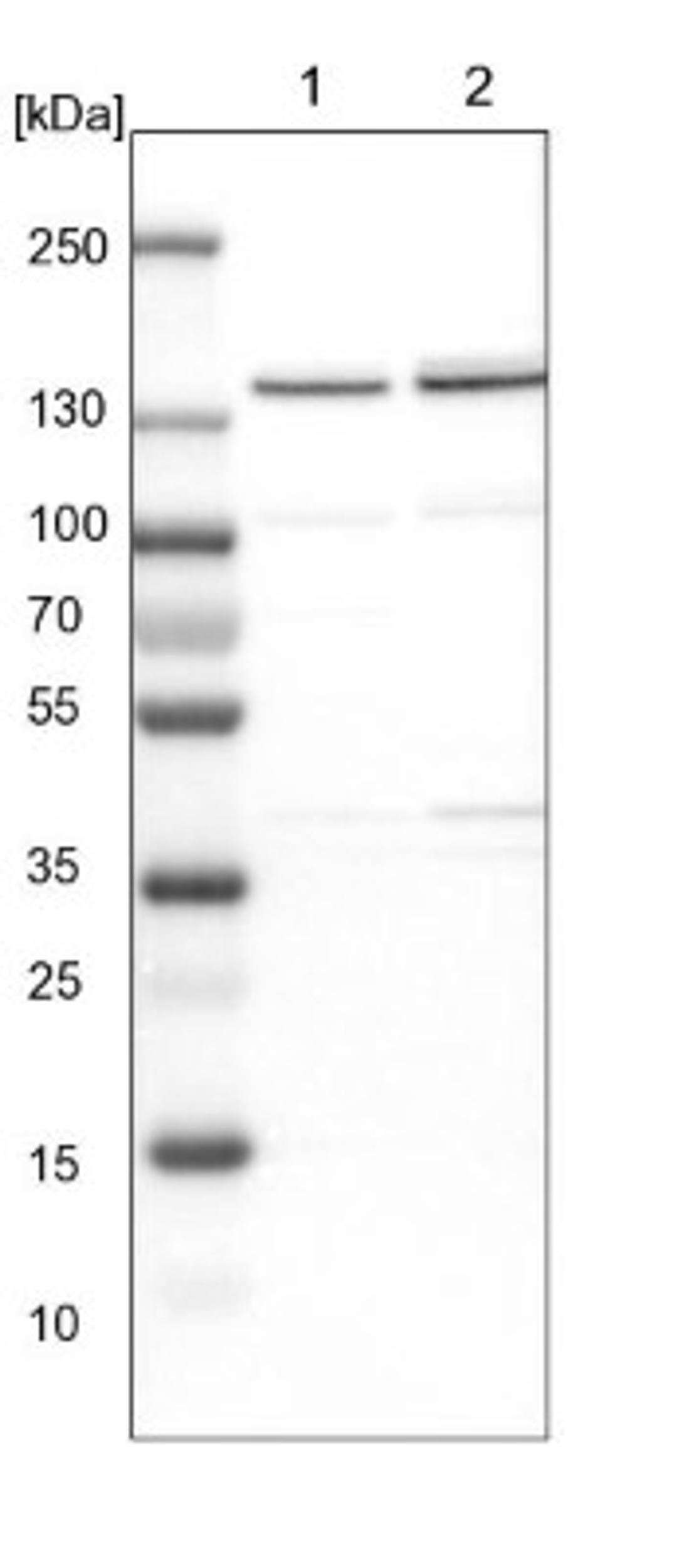 Western Blot: DBC1 Antibody [NBP1-85305] - Lane 1: NIH-3T3 cell lysate (Mouse embryonic fibroblast cells)<br/>Lane 2: NBT-II cell lysate (Rat Wistar bladder tumour cells)