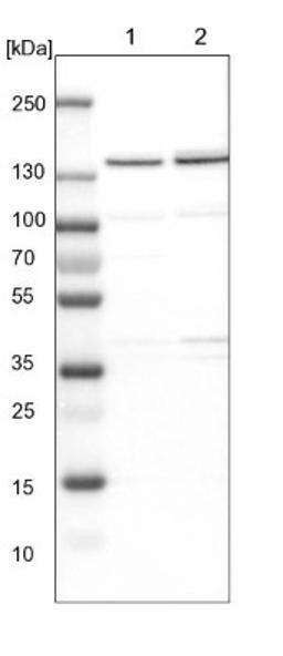 Western Blot: DBC1 Antibody [NBP1-85305] - Lane 1: NIH-3T3 cell lysate (Mouse embryonic fibroblast cells)<br/>Lane 2: NBT-II cell lysate (Rat Wistar bladder tumour cells)