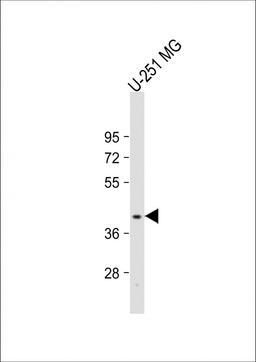 Western Blot at 1:2000 dilution + U-251 MG whole cell lysate Lysates/proteins at 20 ug per lane.