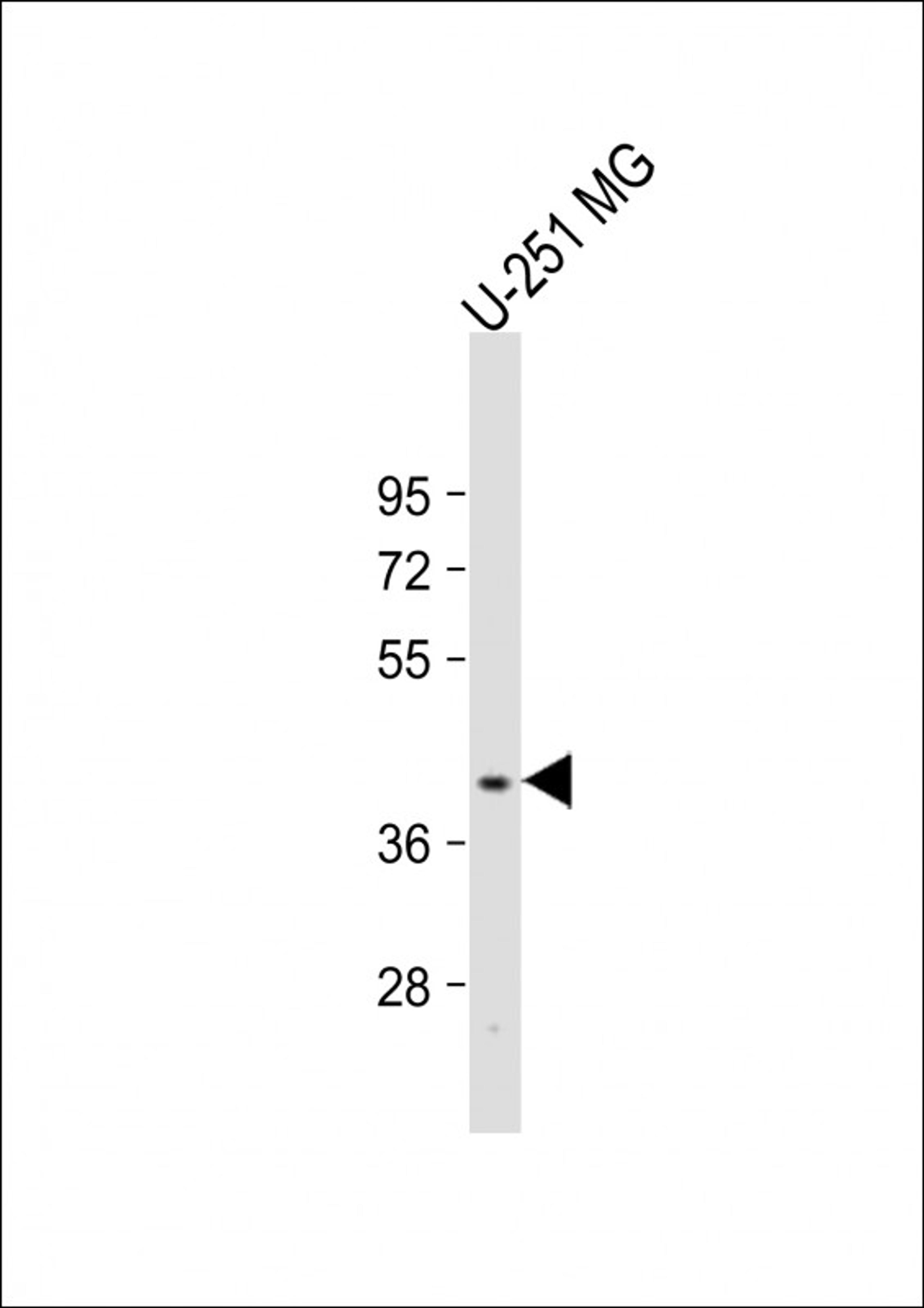 Western Blot at 1:2000 dilution + U-251 MG whole cell lysate Lysates/proteins at 20 ug per lane.