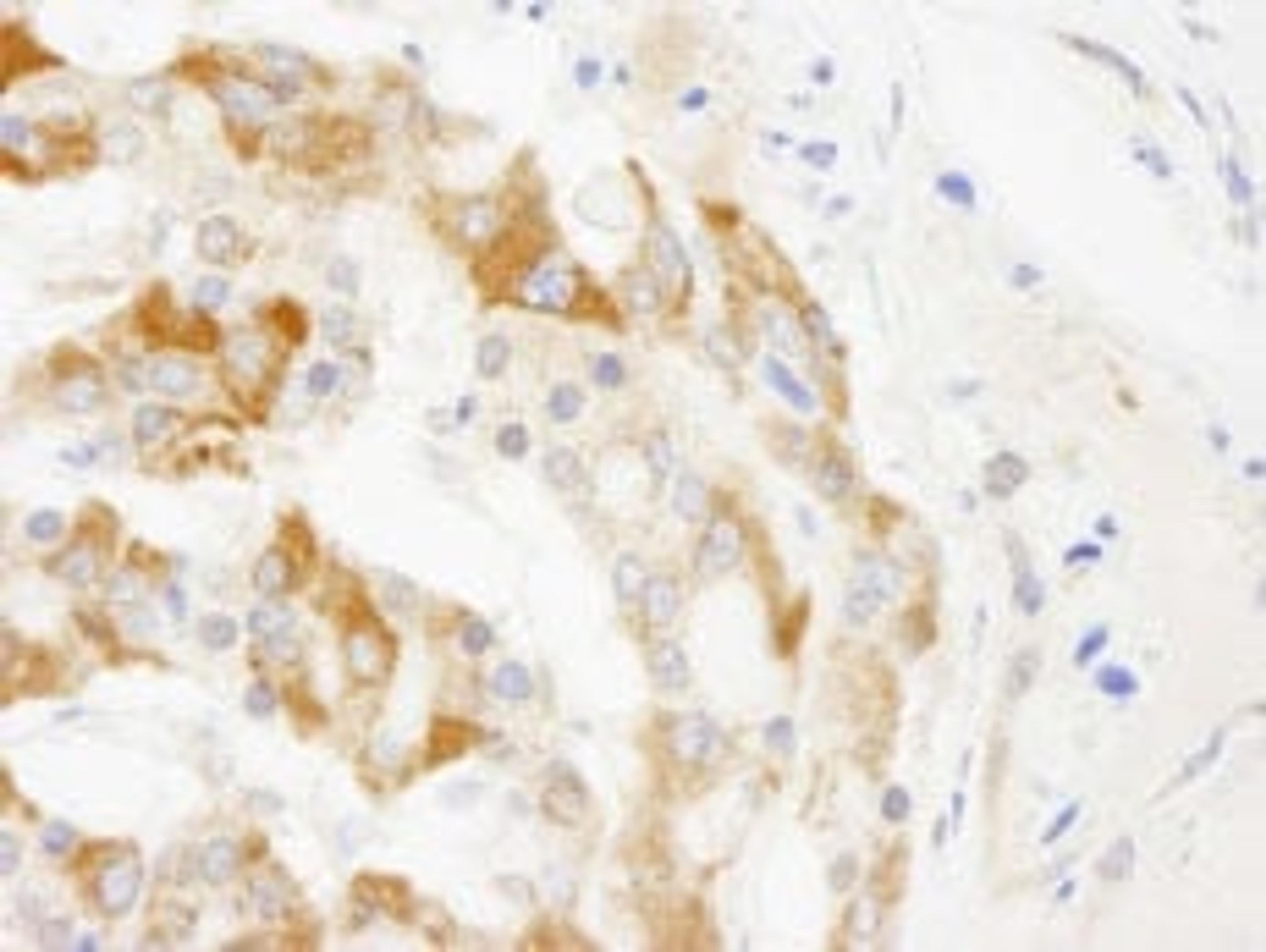 Detection of human TRIM3/BERP by immunohistochemistry.