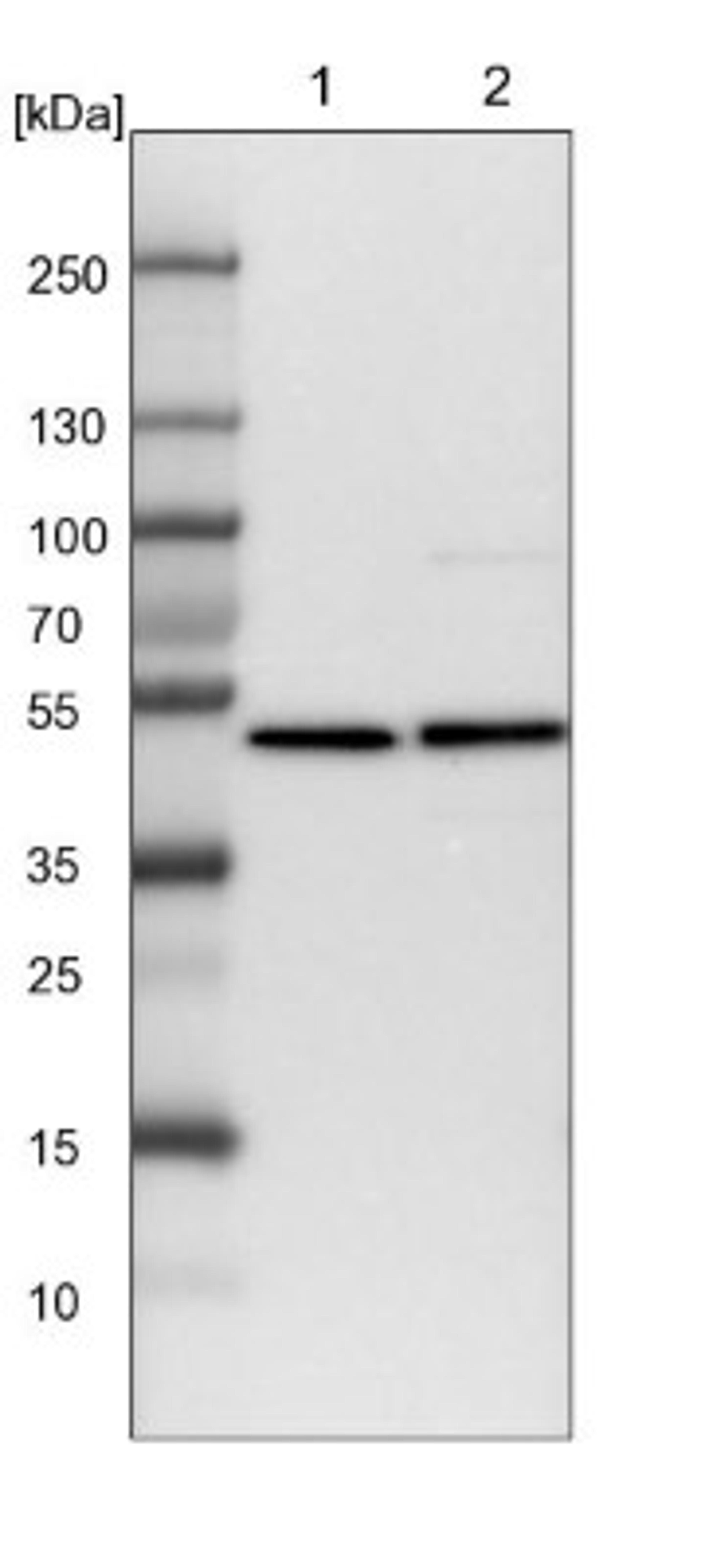 Western Blot: HADHB Antibody [NBP1-82609] - Lane 1: NIH-3T3 cell lysate (Mouse embryonic fibroblast cells)<br/>Lane 2: NBT-II cell lysate (Rat Wistar bladder tumour cells)