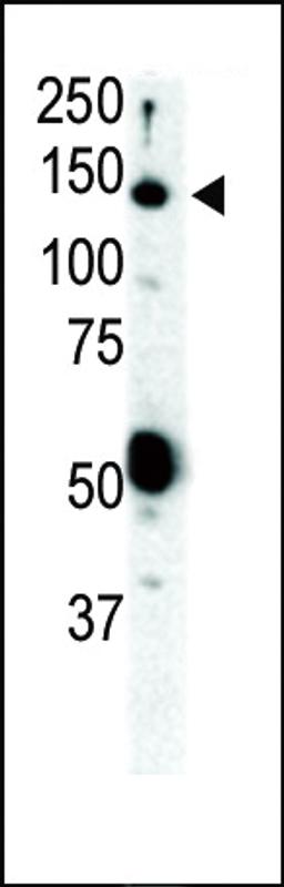 Western blot analysis of anti-Ret Pab in SKBR3 cell lysate