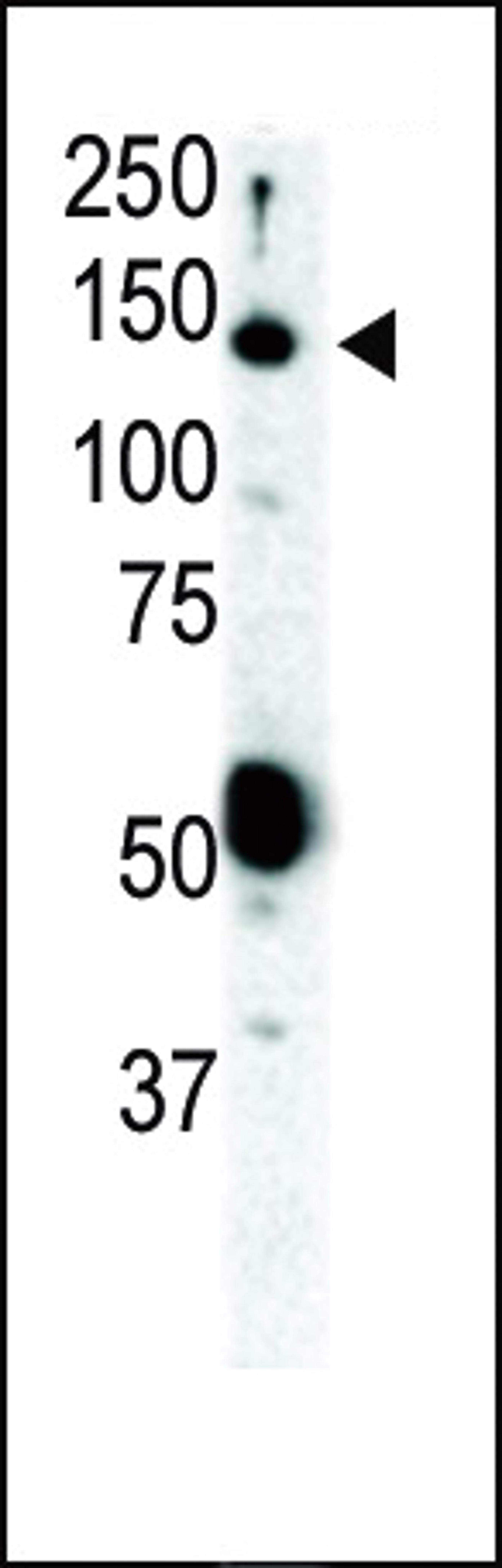 Western blot analysis of anti-Ret Pab in SKBR3 cell lysate