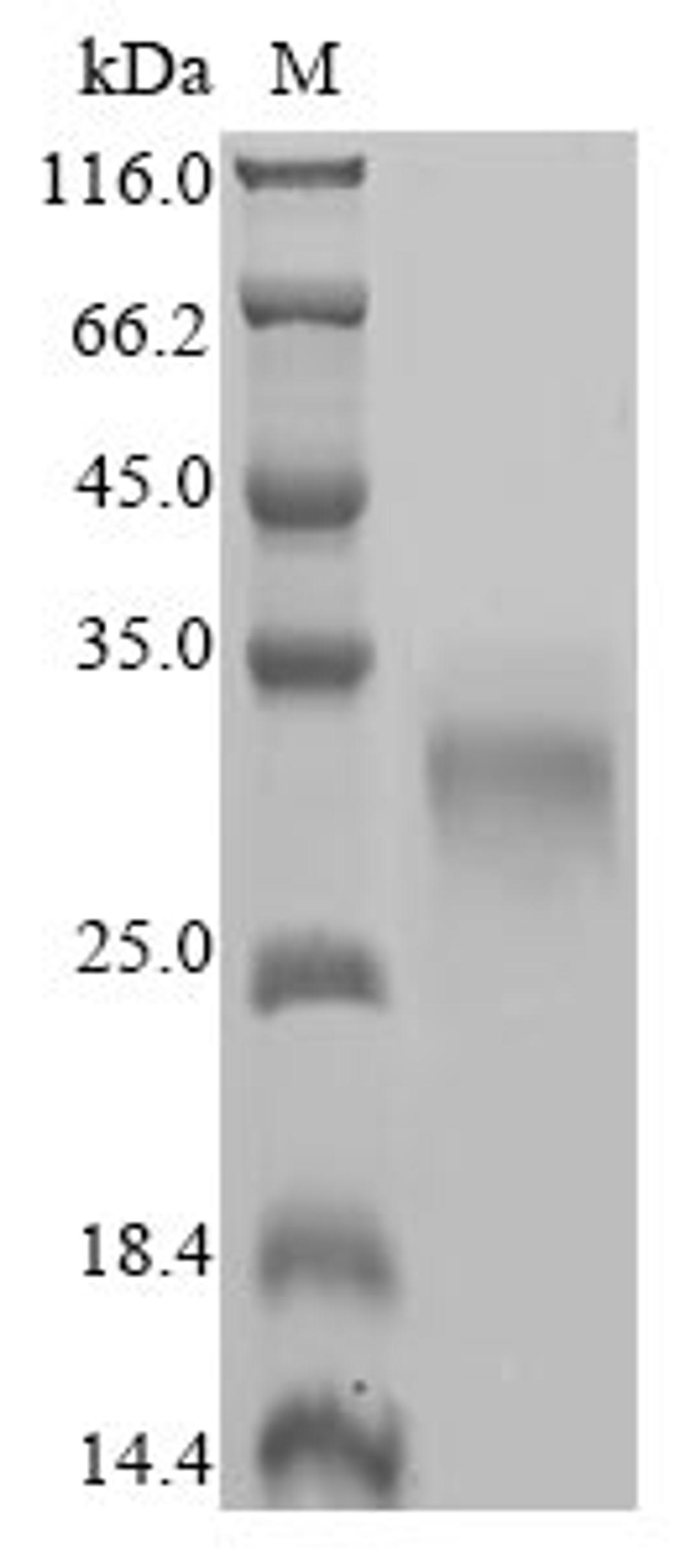 (Tris-Glycine gel) Discontinuous SDS-PAGE (reduced) with 5% enrichment gel and 15% separation gel.