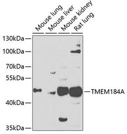 Western blot - TMEM184A antibody (A7857)