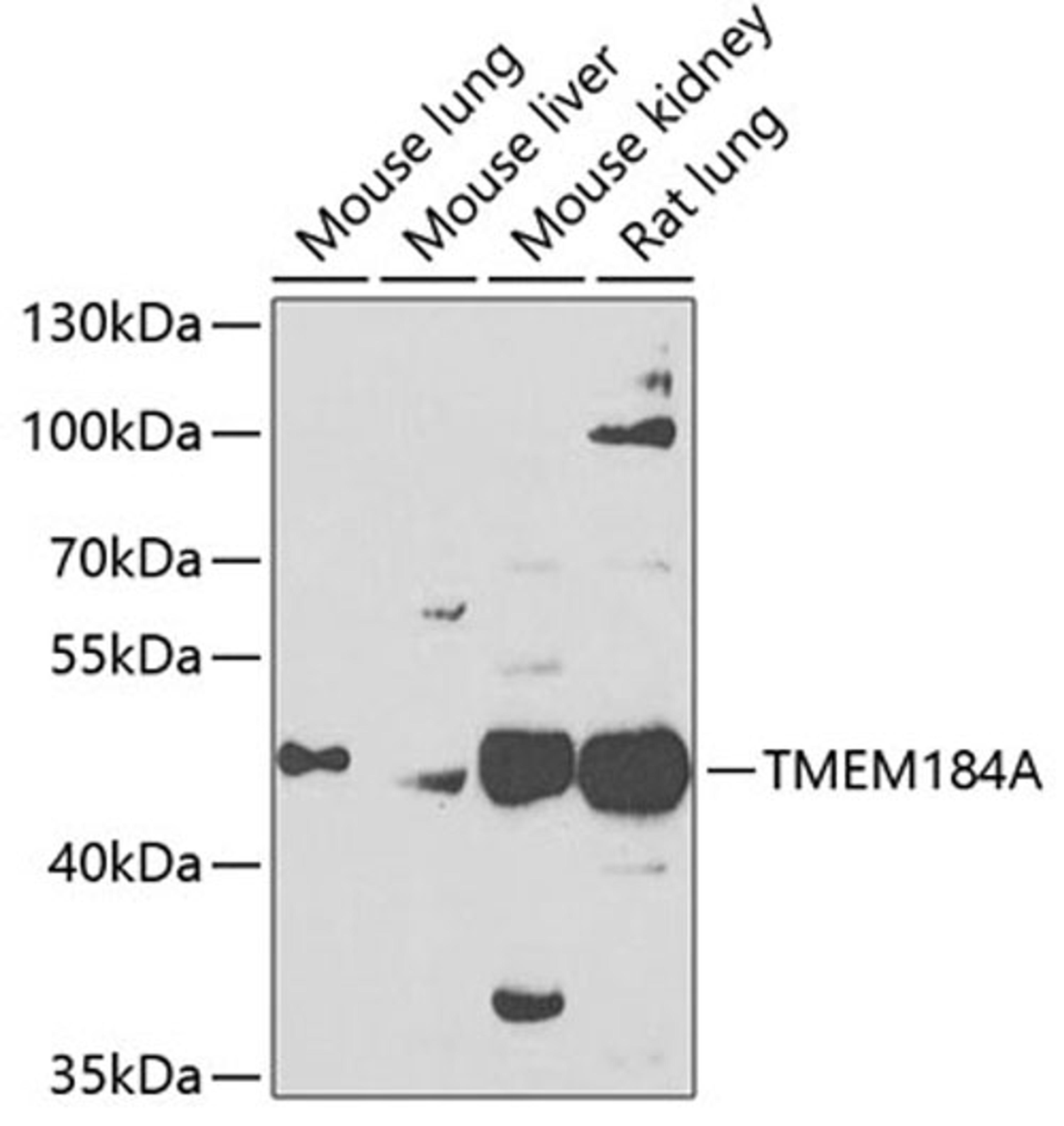 Western blot - TMEM184A antibody (A7857)