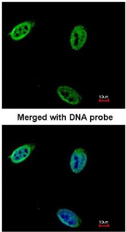 Immunocytochemistry/Immunofluorescence: Nucleoporin p62 Antibody [NBP1-31381] - Analysis of HeLa, using NBP1-31381 at 1:200 dilution.