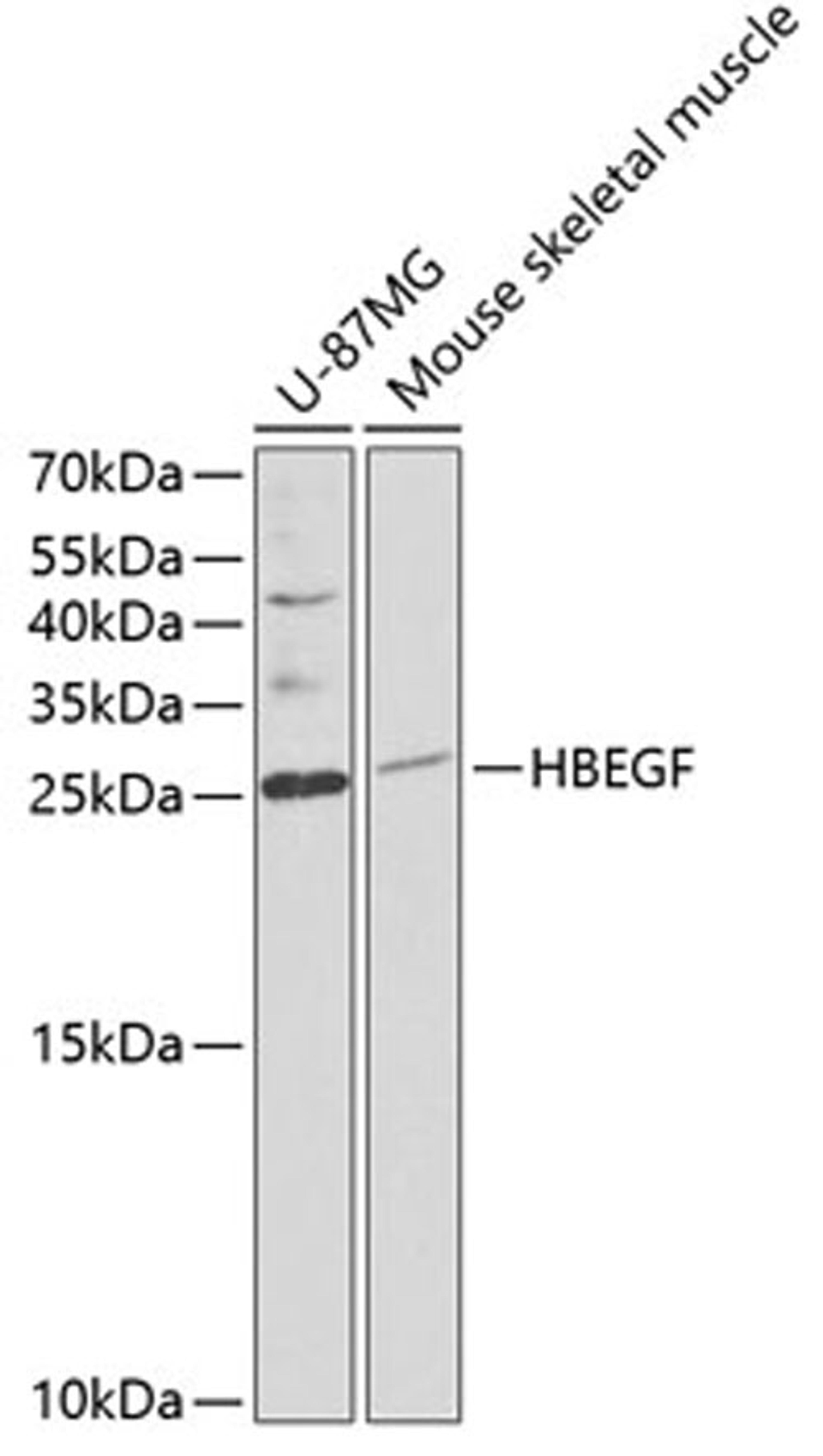 Western blot - HBEGF antibody (A1695)