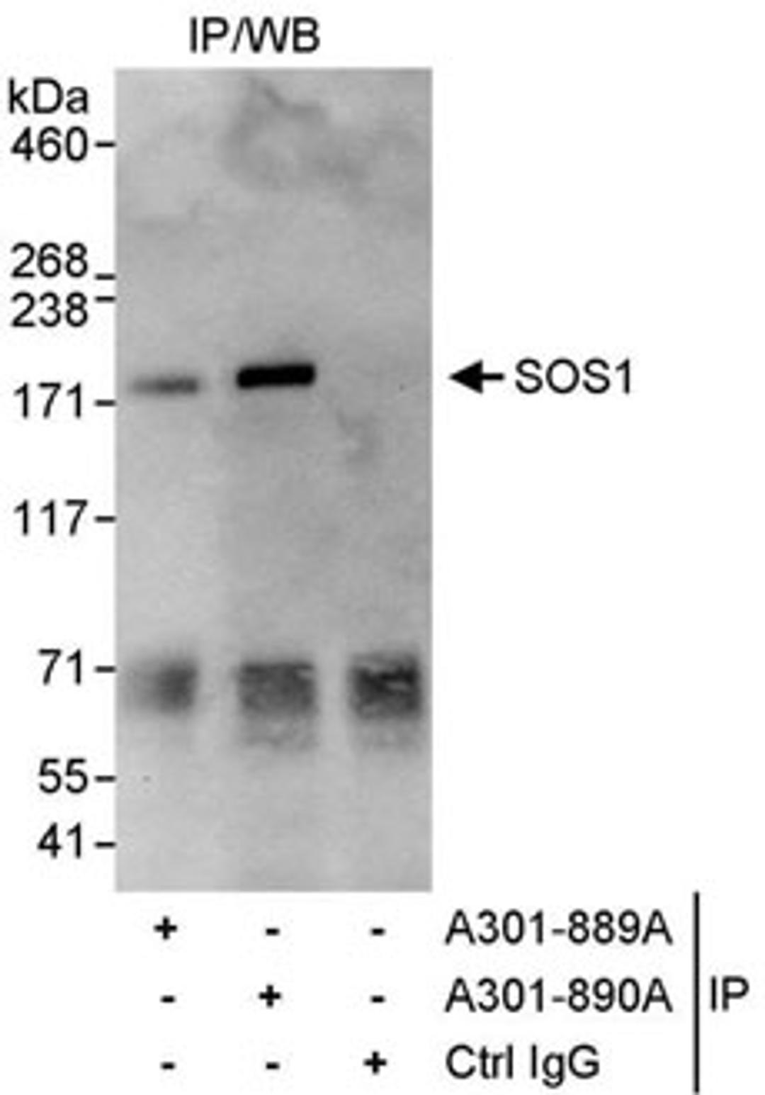 Detection of human SOS1 by western blot of immunoprecipitates.