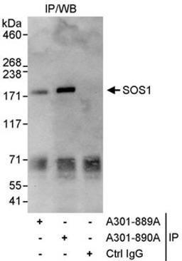 Detection of human SOS1 by western blot of immunoprecipitates.