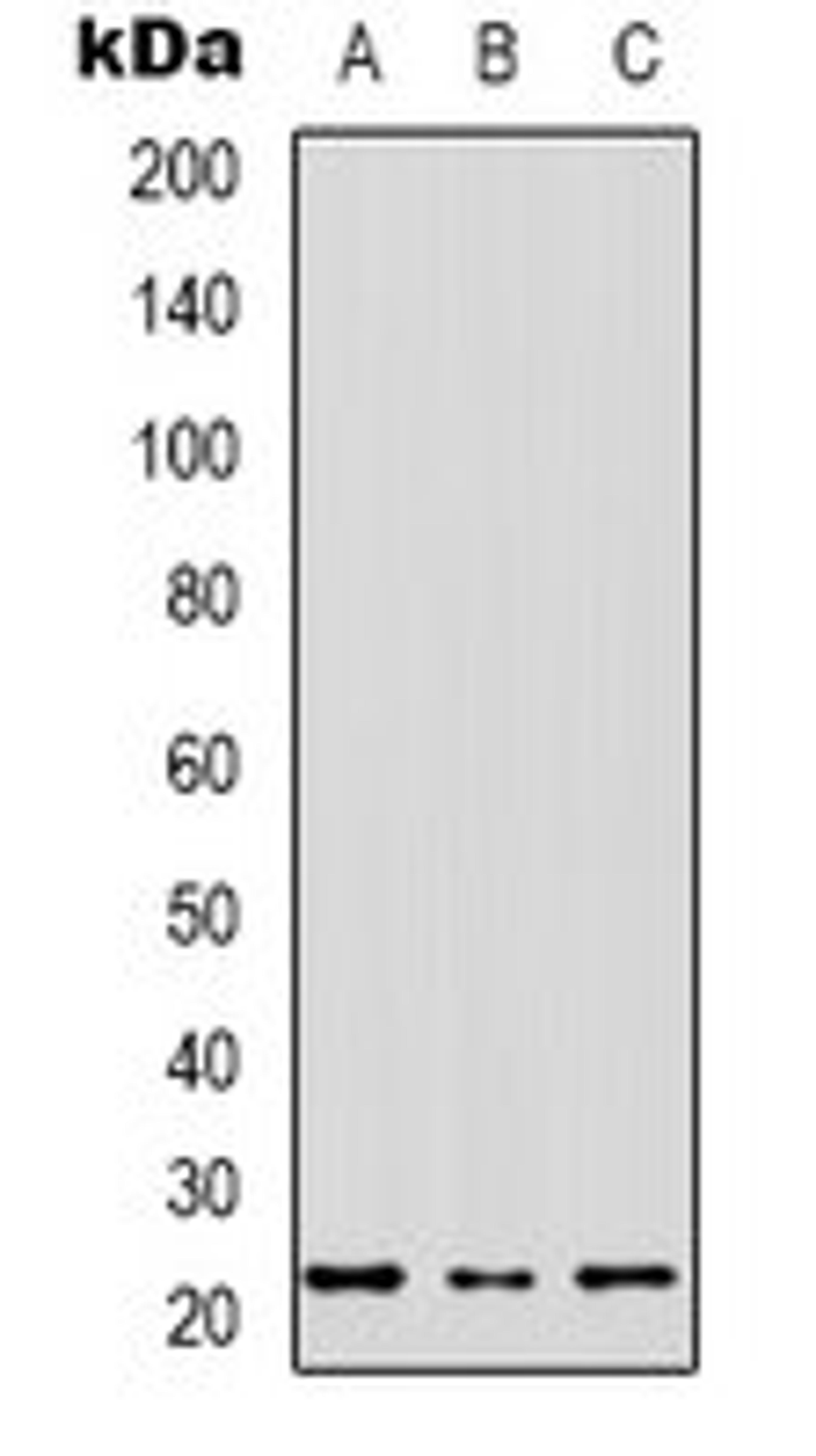 Western blot analysis of SHSY5Y (Lane 1), HEK293T (Lane 2), NIH3T3 (Lane 3) whole cell lysates using MRPS17 antibody