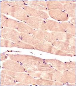 Immunohistochemistry-Paraffin: Glut4 Antibody (2E11NB) [NBP2-44299] - IHC analysis of a formalin fixed and paraffin embedded tissue section of normal human skeletal muscle using 1:200 dilution of Glut4 antibody (clone 2E11NB). The antibody generated a diffused staining in the blood vessels as well as the cytoplasm/sarcoplasma of skeletal muscles while the nuclei did not show any positivity for Glut4.