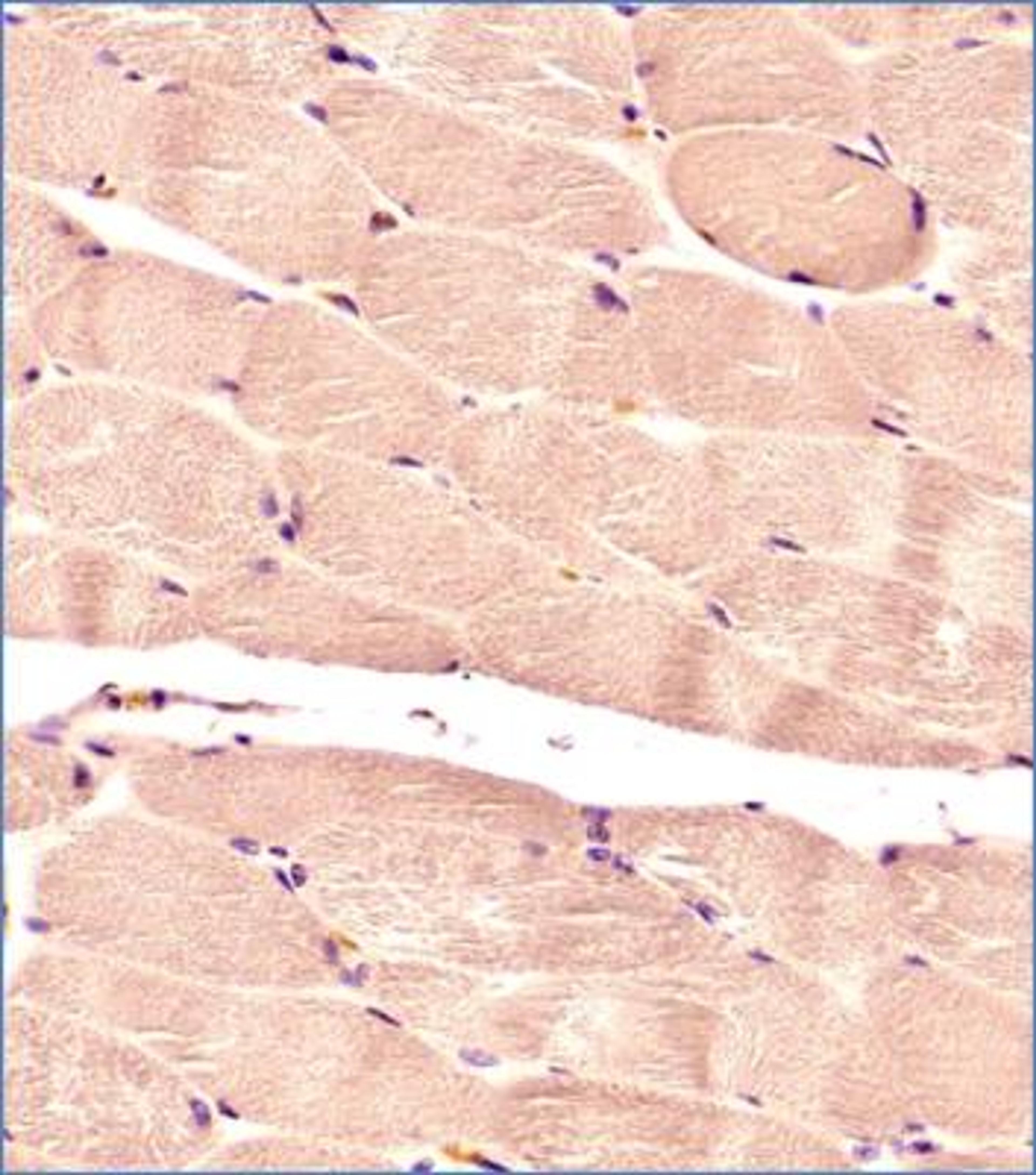 Immunohistochemistry-Paraffin: Glut4 Antibody (2E11NB) [NBP2-44299] - IHC analysis of a formalin fixed and paraffin embedded tissue section of normal human skeletal muscle using 1:200 dilution of Glut4 antibody (clone 2E11NB). The antibody generated a diffused staining in the blood vessels as well as the cytoplasm/sarcoplasma of skeletal muscles while the nuclei did not show any positivity for Glut4.