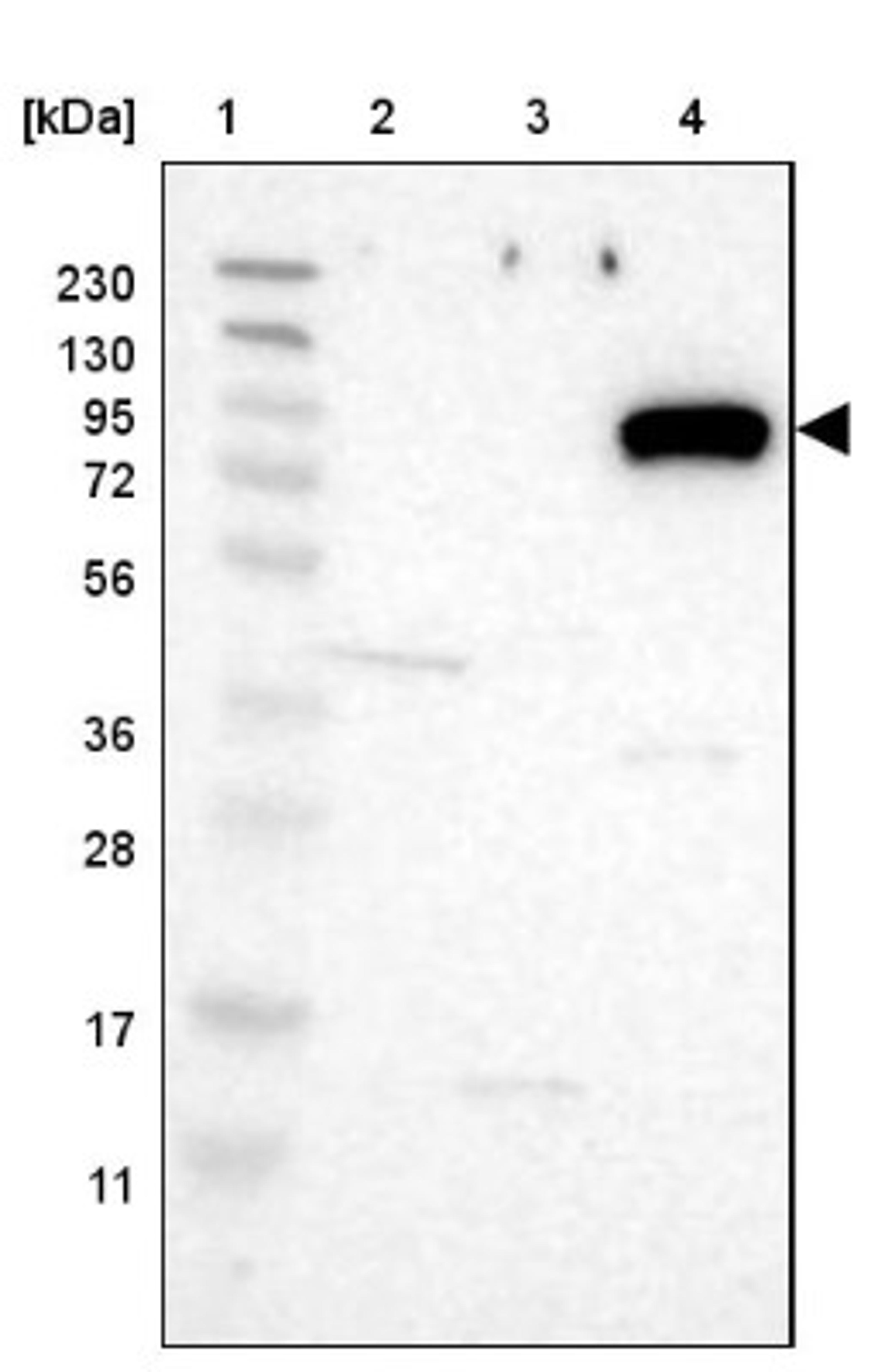 Western Blot: SLC6A9 Antibody [NBP1-81820] - Lane 1: Marker [kDa] 230, 130, 95, 72, 56, 36, 28, 17, 11<br/>Lane 2: Human cell line RT-4<br/>Lane 3: Human cell line U-251MG sp<br/>Lane 4: Human plasma (IgG/HSA depleted)