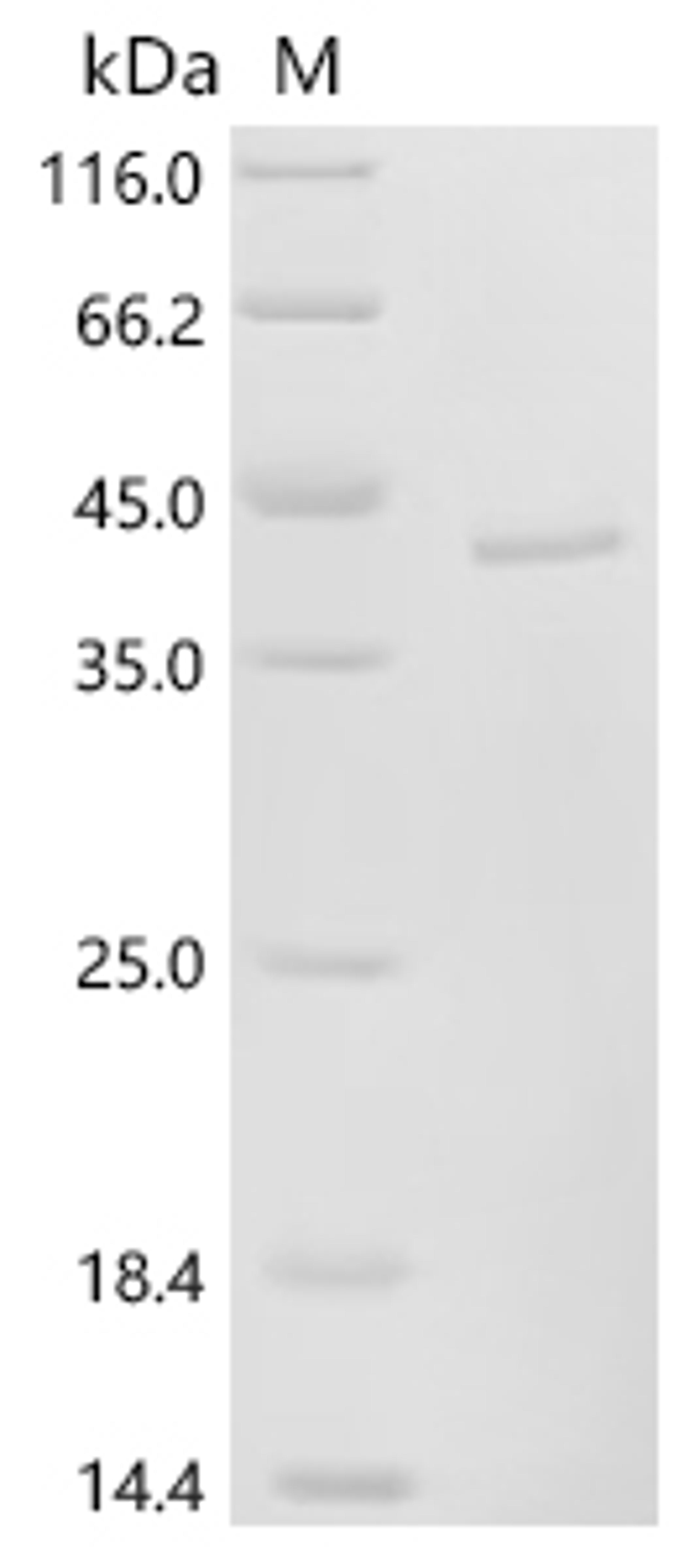 (Tris-Glycine gel) Discontinuous SDS-PAGE (reduced) with 5% enrichment gel and 15% separation gel.