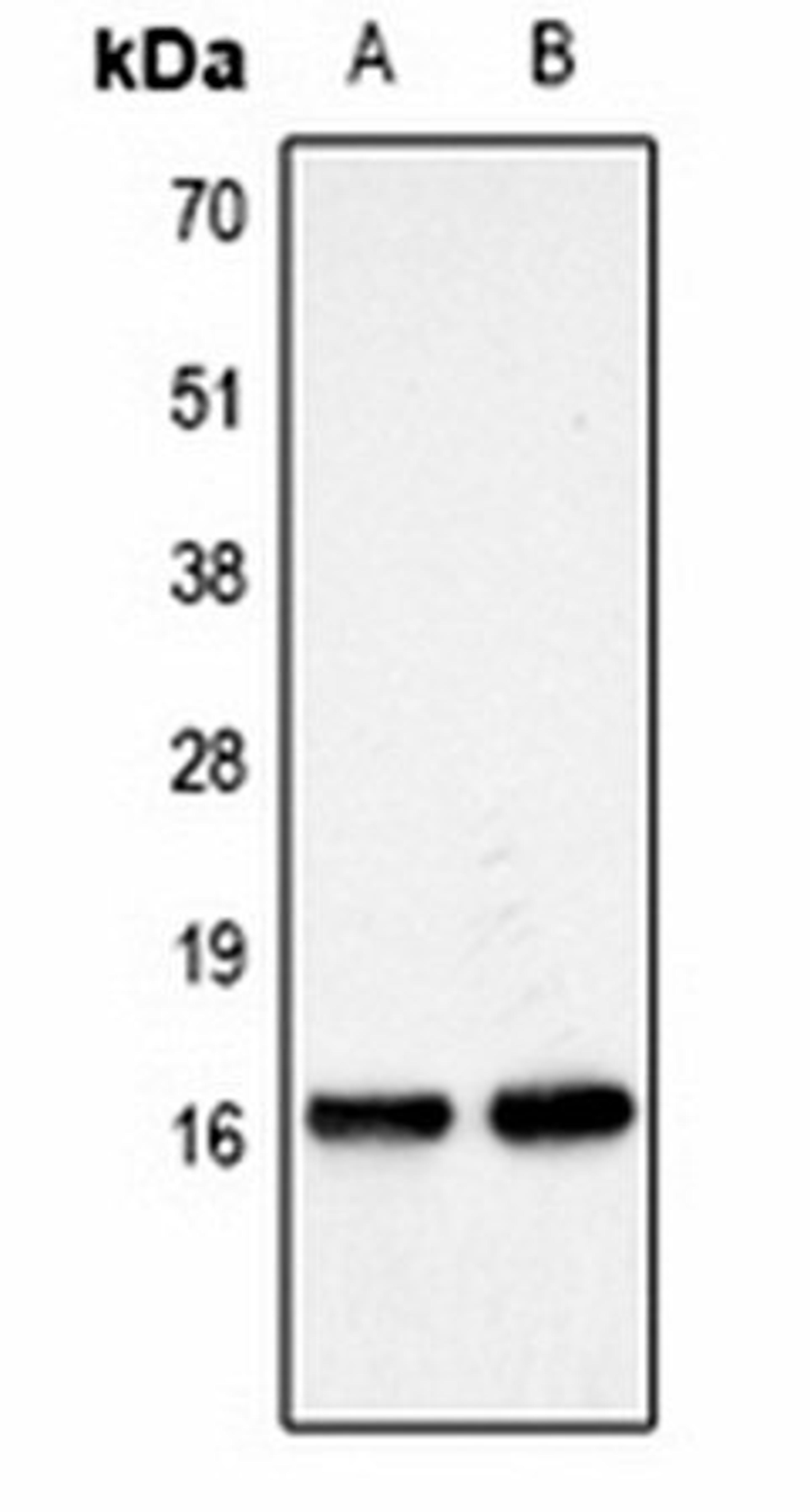 Western blot analysis of  Hela (Lane1), NIH3T3 (Lane2) whole cell lysates using Histone H3 (MonoMethyl K27) antibody