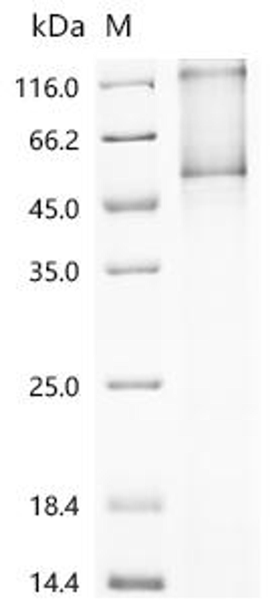 (Tris-Glycine gel) Discontinuous SDS-PAGE (reduced) with 5% enrichment gel and 15% separation gel.
