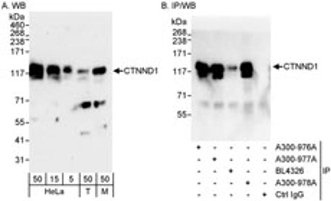 Detection of human and mouse CTNND1 by western blot (h&m) and immunoprecipitation (h).