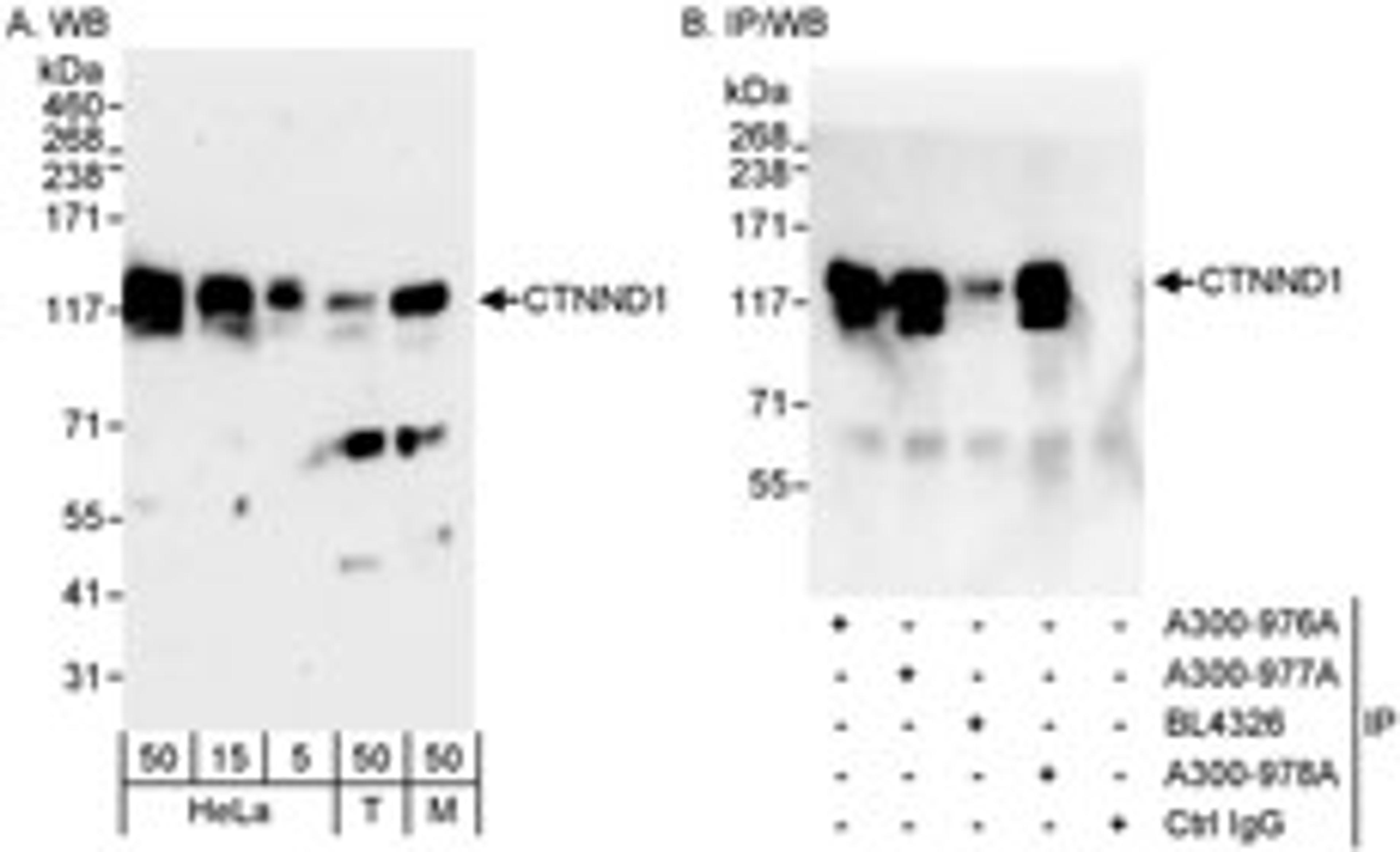 Detection of human and mouse CTNND1 by western blot (h&m) and immunoprecipitation (h).