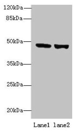 Western blot. All lanes: TENT5B antibody at 6µg/ml. Lane 1: 293T whole cell lysate. Lane 2: Hela whole cell lysate. Secondary. Goat polyclonal to rabbit IgG at 1/10000 dilution. Predicted band size: 47 kDa. Observed band size: 47 kDa