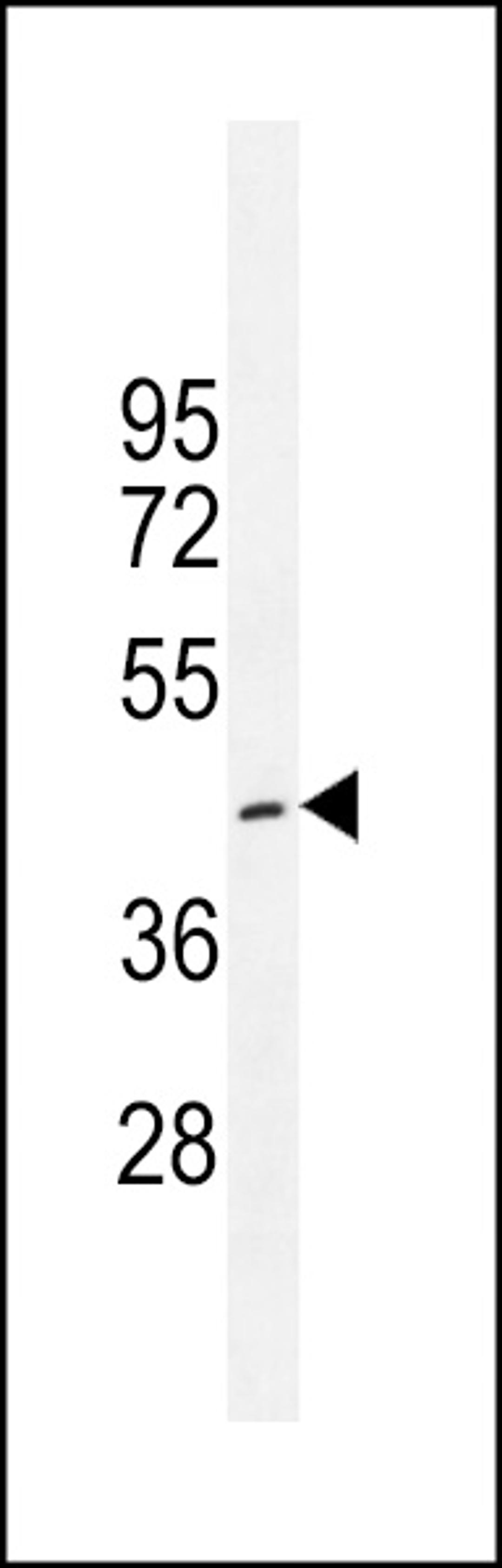 Western blot analysis in K562 cell line lysates (35ug/lane).