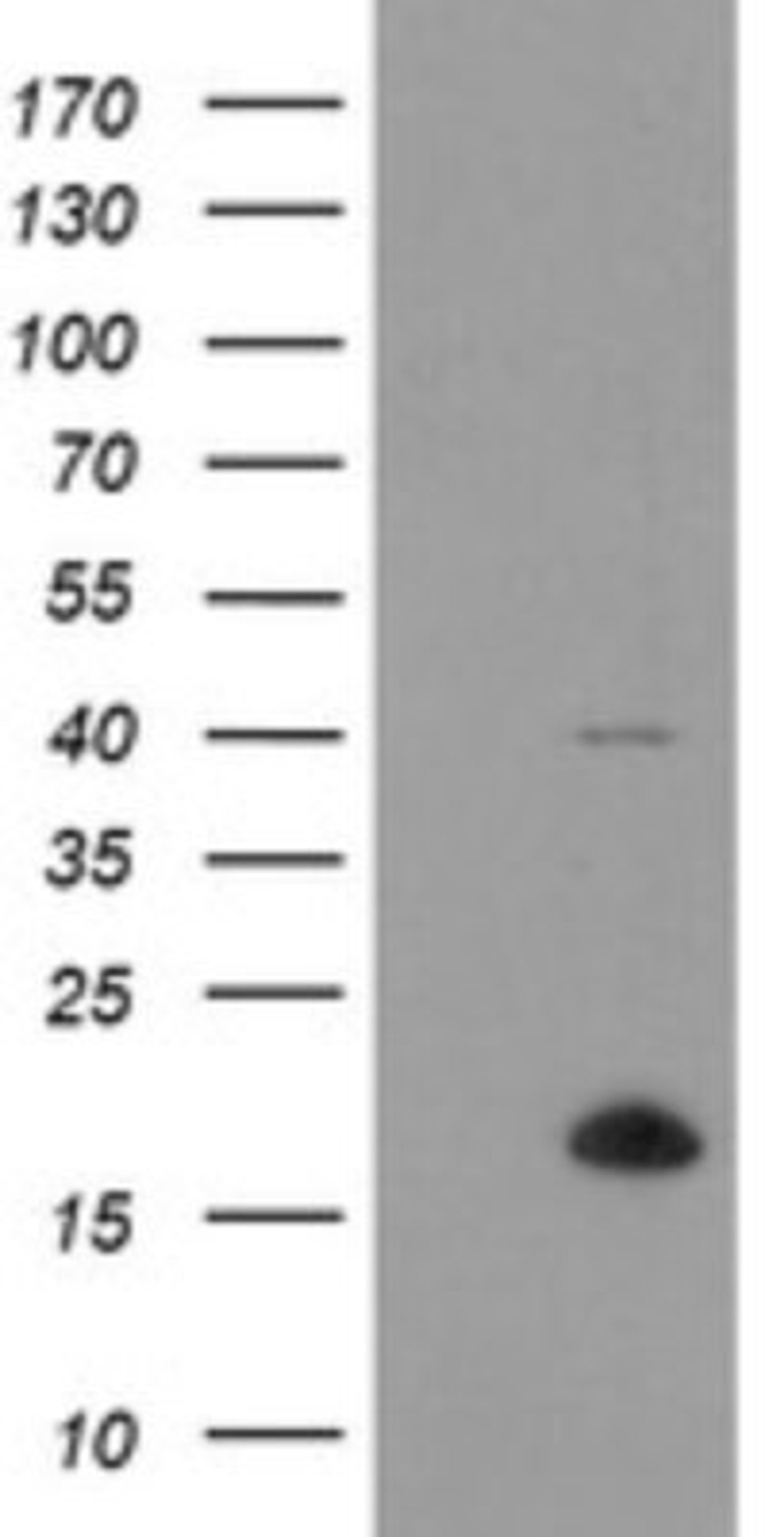 Western Blot: TPD52L3/D55 Antibody (8C12) [NBP2-46012] - Analysis of HEK293T cells were transfected with the pCMV6-ENTRY control (Left lane) or pCMV6-ENTRY TPD52L3.