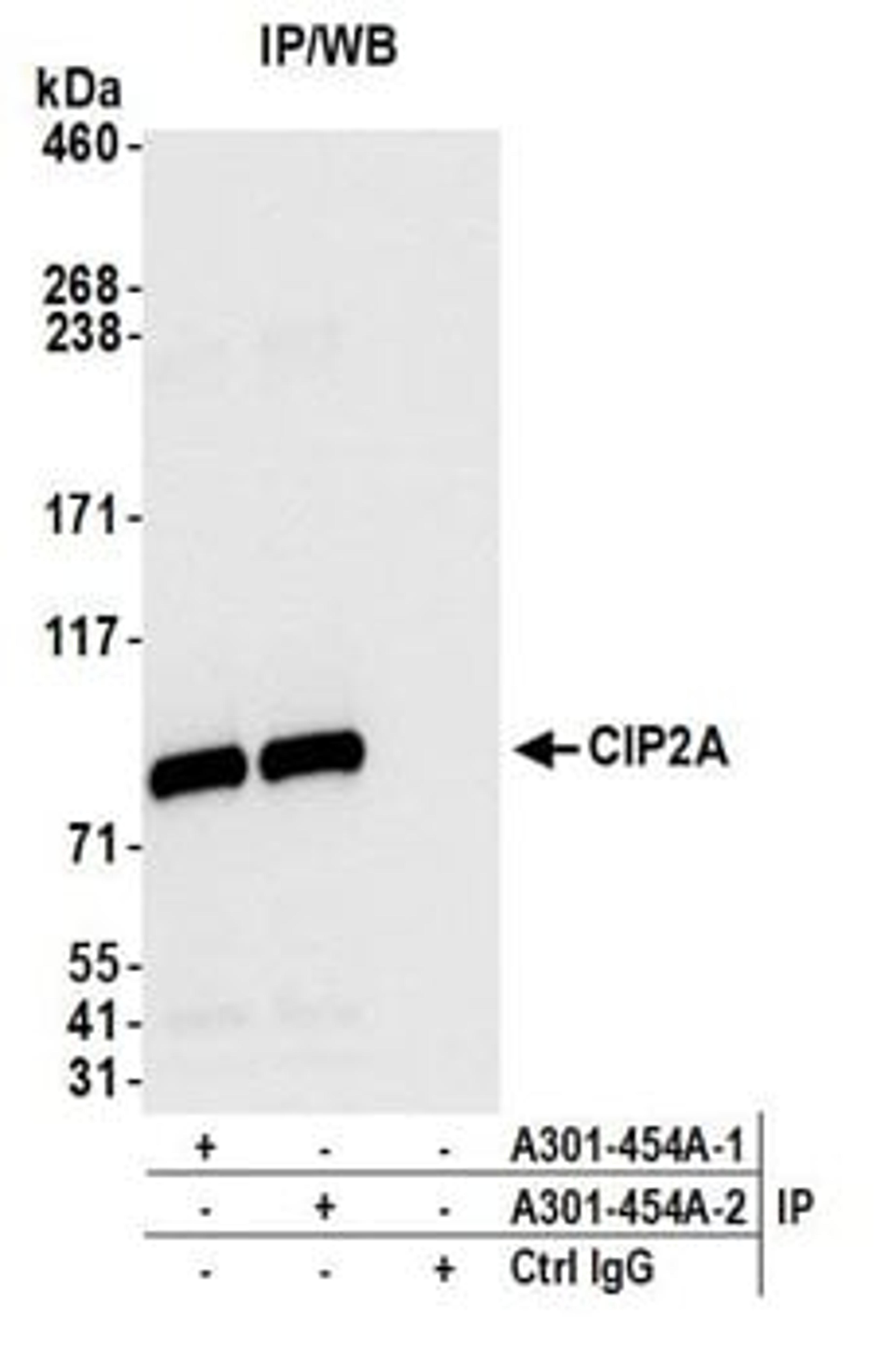 Detection of human CIP2A by western blot of immunoprecipitates.