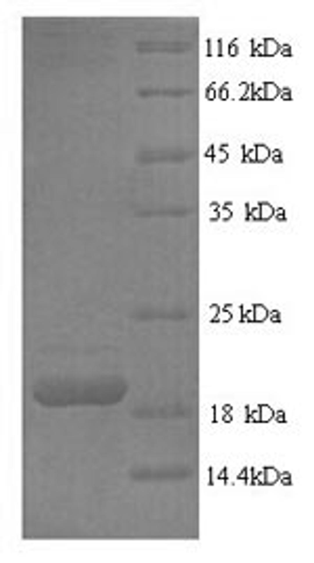 (Tris-Glycine gel) Discontinuous SDS-PAGE (reduced) with 5% enrichment gel and 15% separation gel.