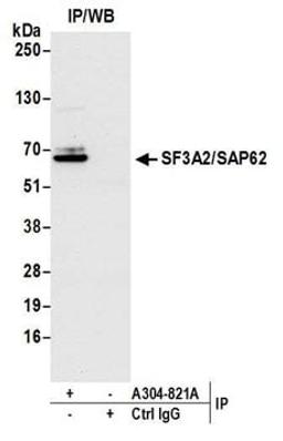 Detection of human SF3A2/SAP62 by western blot of immunoprecipitates.