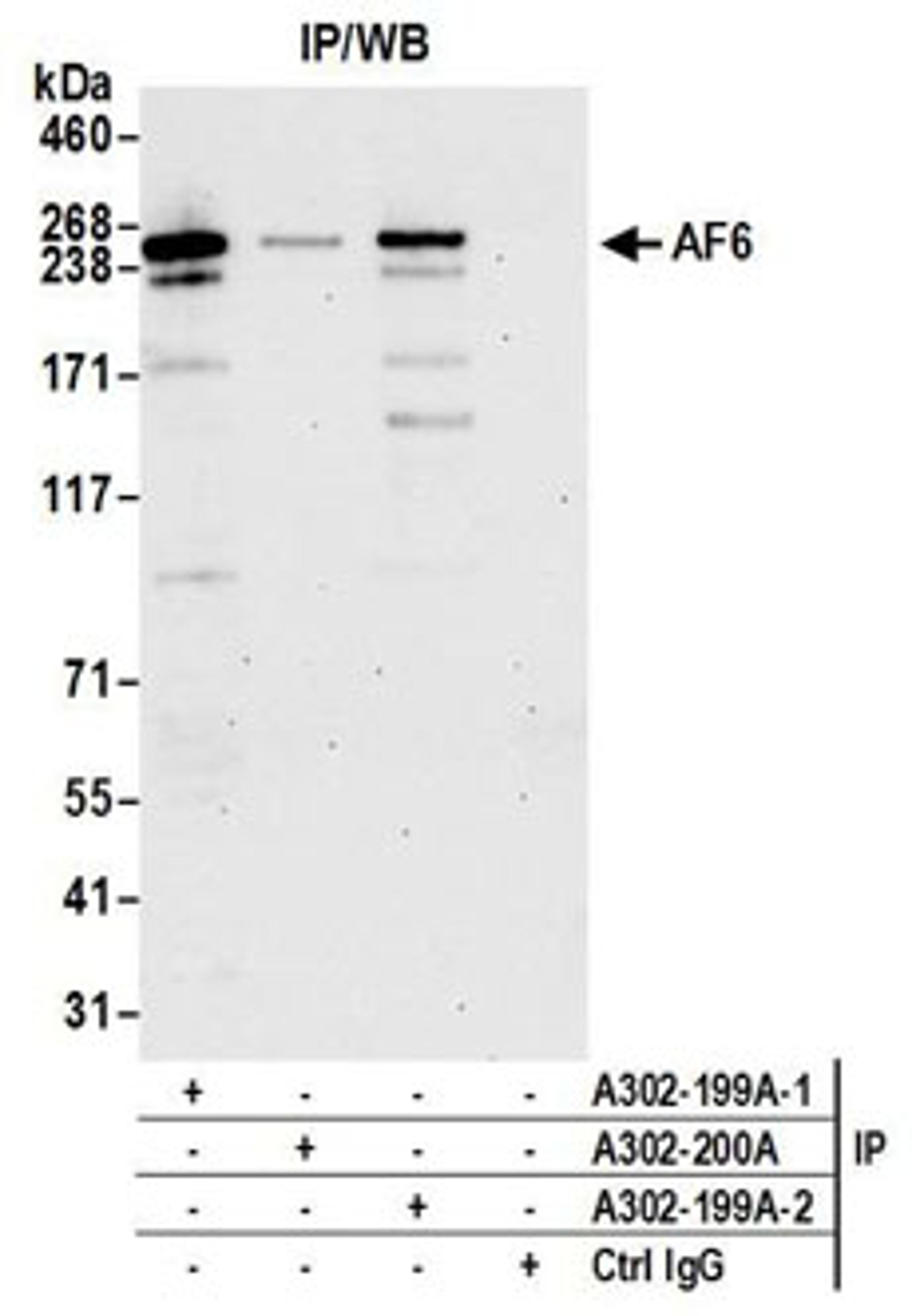 Detection of human AF6 by western blot of immunoprecipitates.