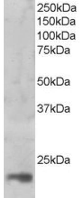 45-856 (1ug/ml) staining of nuclear HeLa lysate (35ug protein in RIPA buffer). Primary incubation was 1 hour. Detected by chemiluminescence.