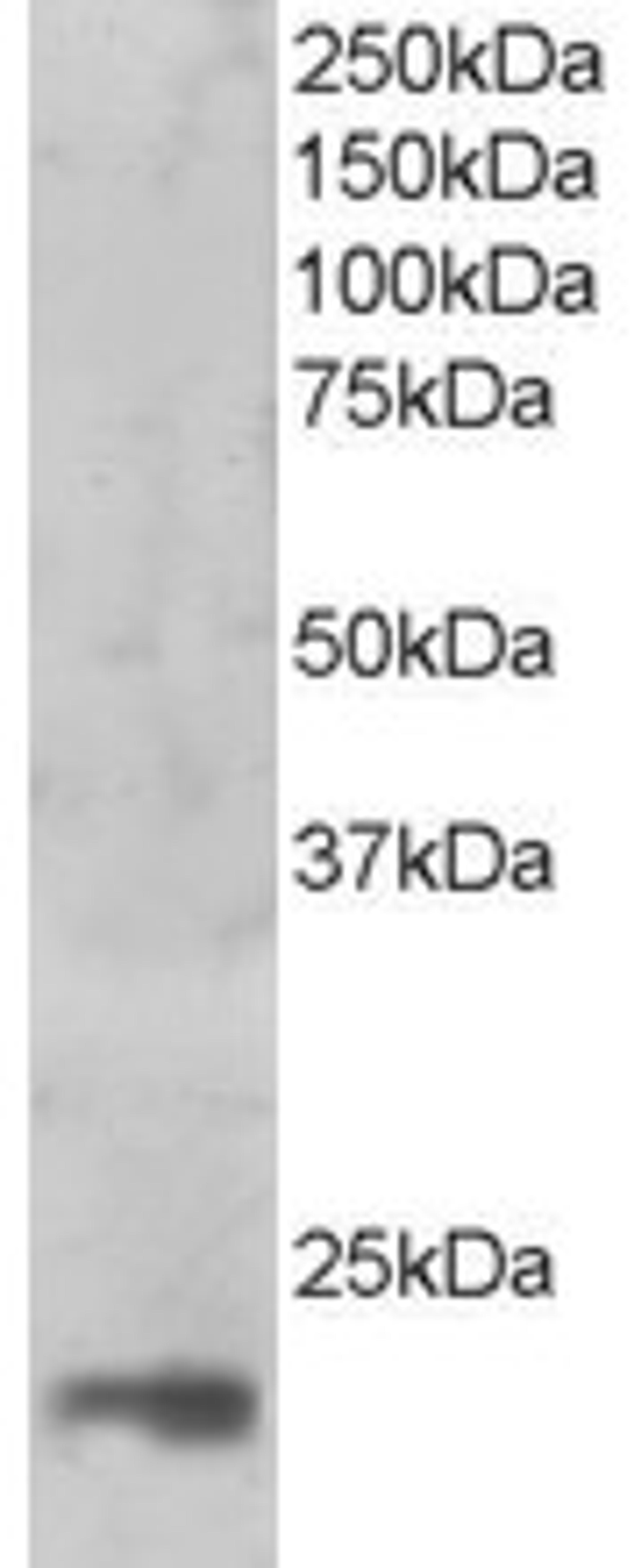 45-856 (1ug/ml) staining of nuclear HeLa lysate (35ug protein in RIPA buffer). Primary incubation was 1 hour. Detected by chemiluminescence.