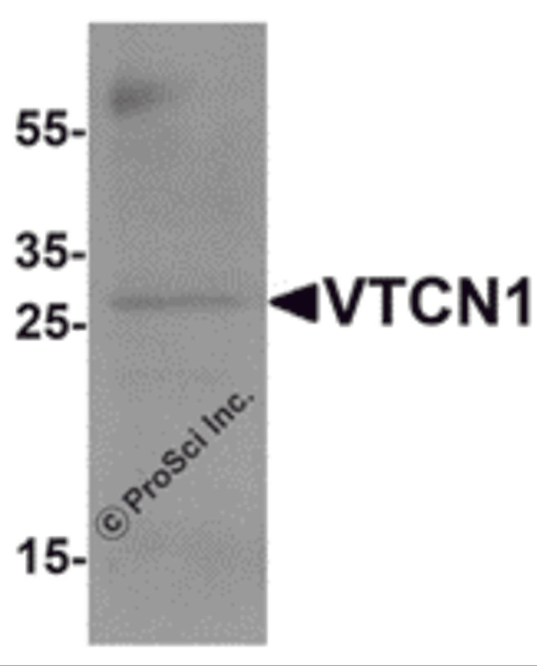 Western blot analysis of VTCN1 in EL4 cell lysate with VTCN1 antibody at 1 &#956;g/mL.