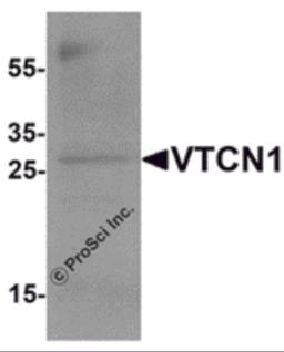 Western blot analysis of VTCN1 in EL4 cell lysate with VTCN1 antibody at 1 &#956;g/mL.