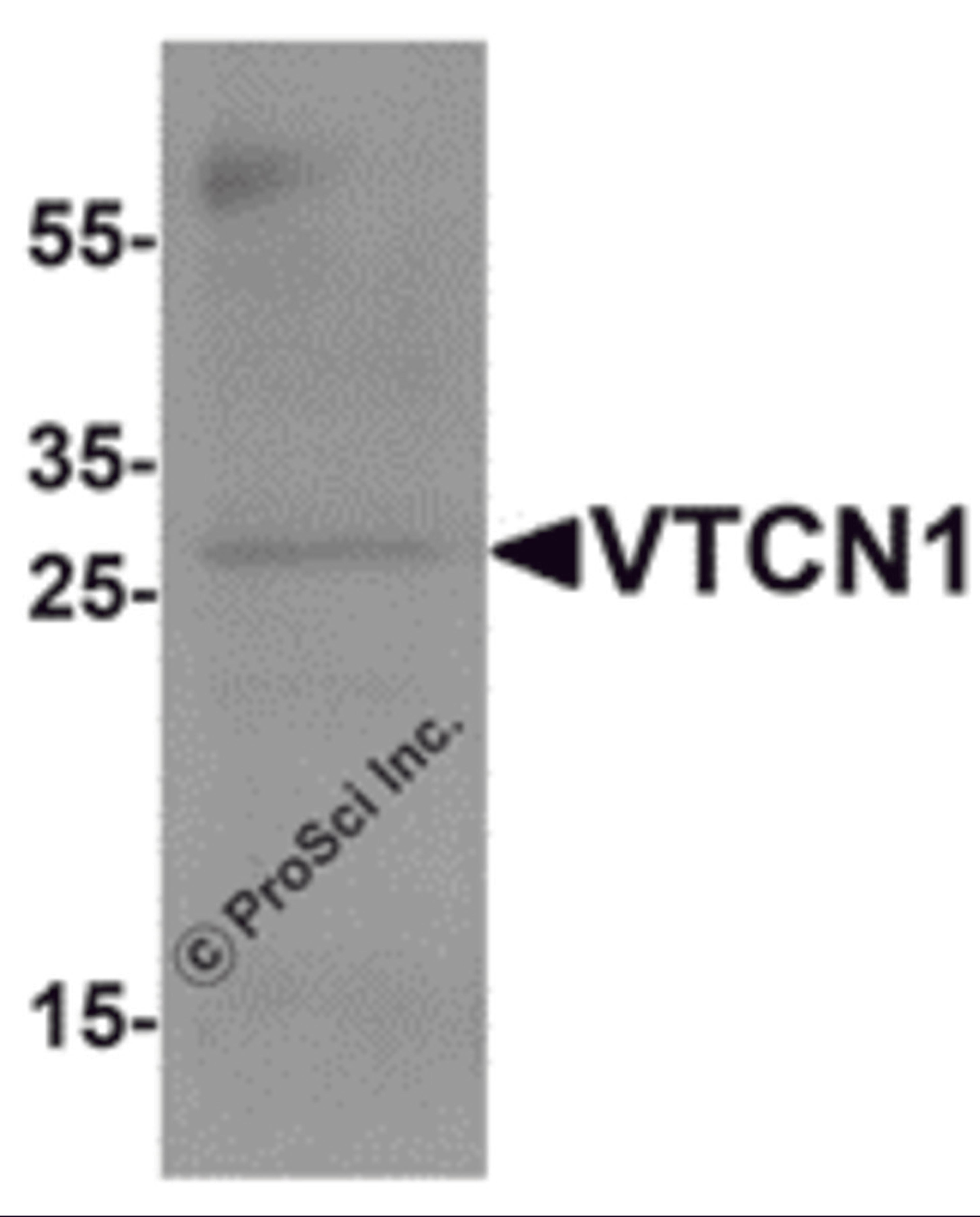 Western blot analysis of VTCN1 in EL4 cell lysate with VTCN1 antibody at 1 μg/mL.