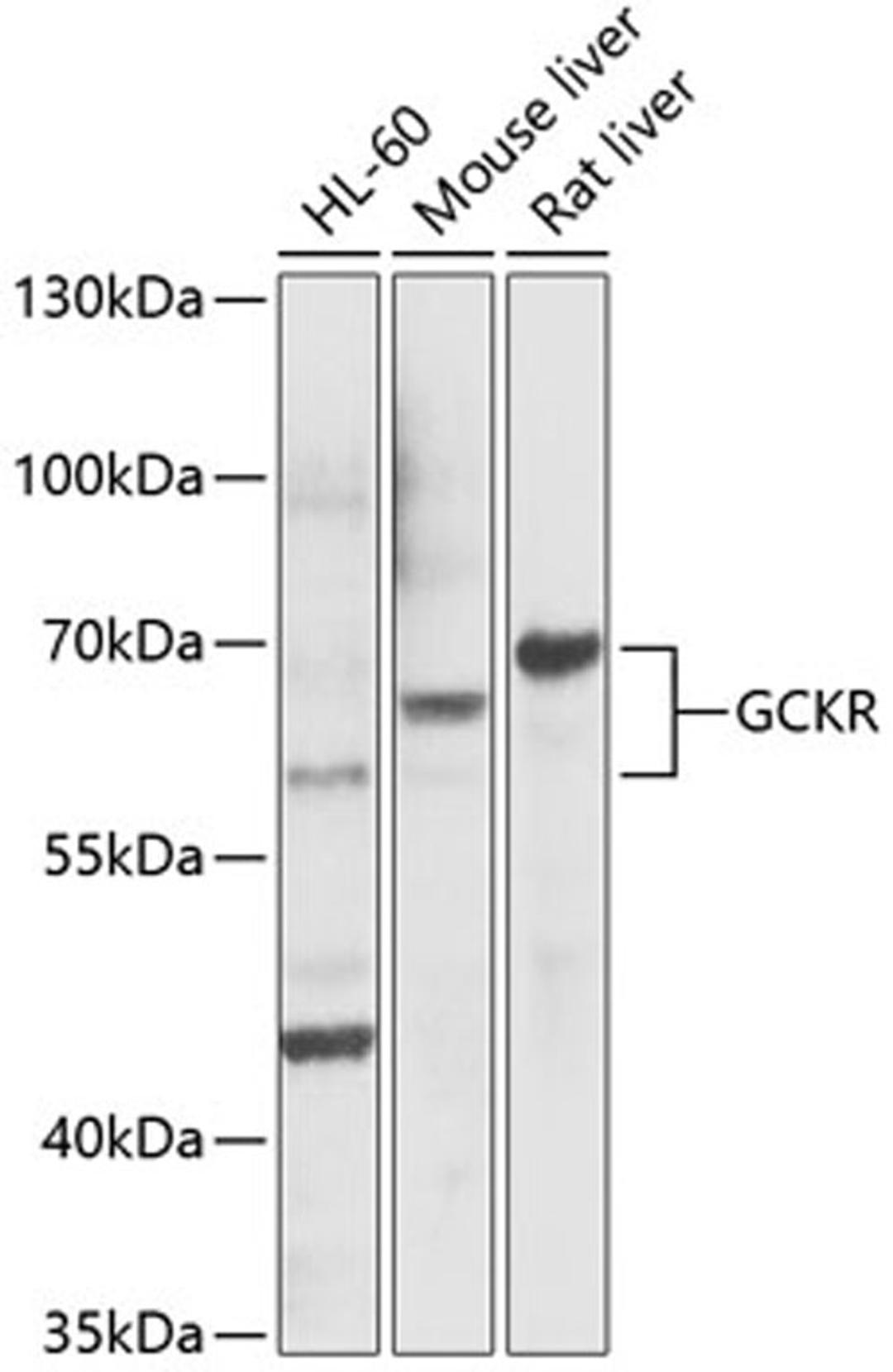 Western blot - GCKR Antibody (A5678)