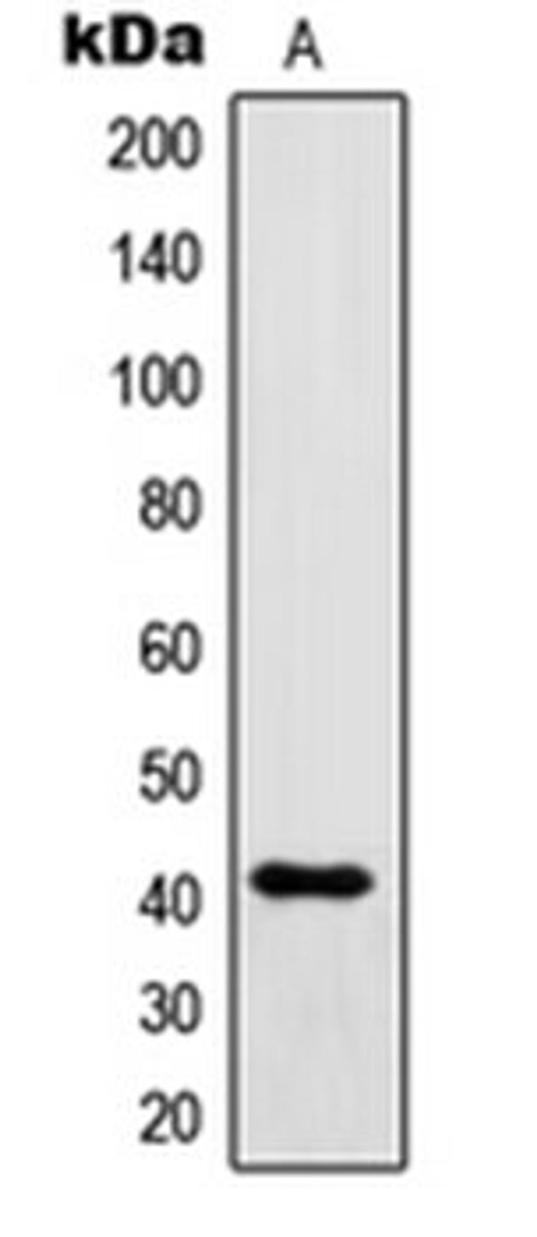 Western blot analysis of IgG recombinant protein (Lane 1) using IGHG1 antibody