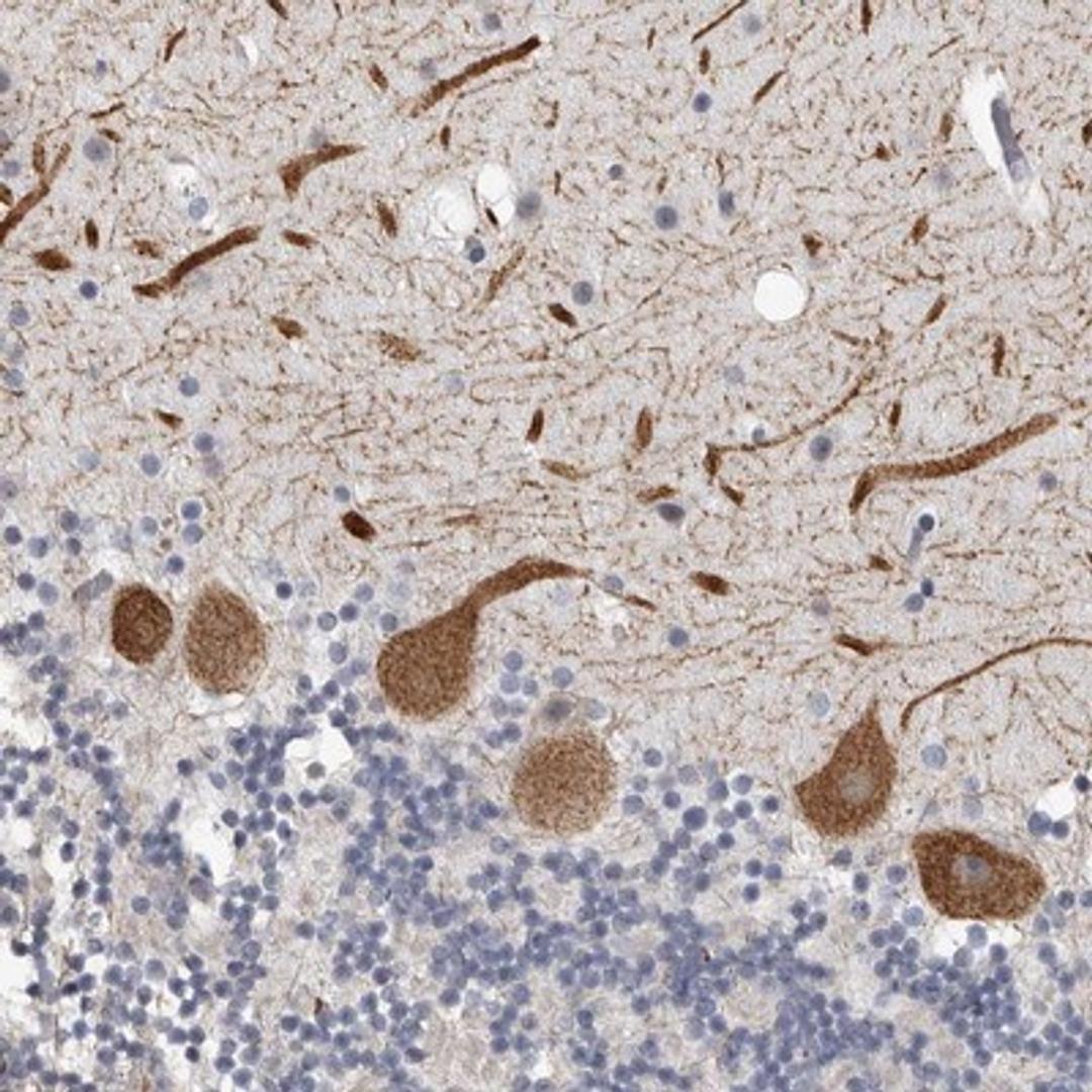 Immunohistochemistry-Paraffin: ARHGEF10 Antibody [NBP1-83373] - Immunohistochemical staining of human cerebellum shows strong cytoplasmic positivity in Purkinje cells.