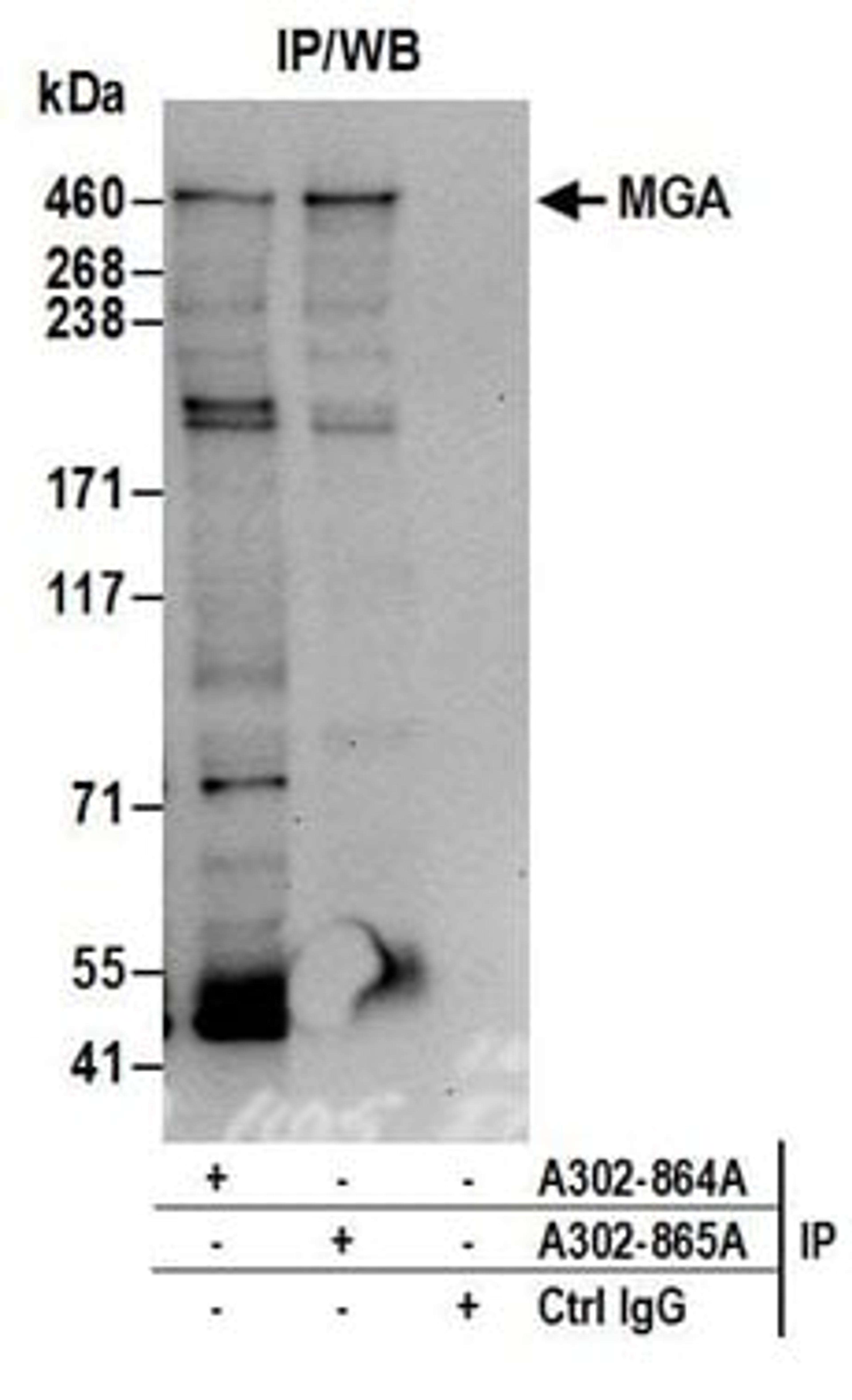 Detection of human MGA by western blot of immunoprecipitates.