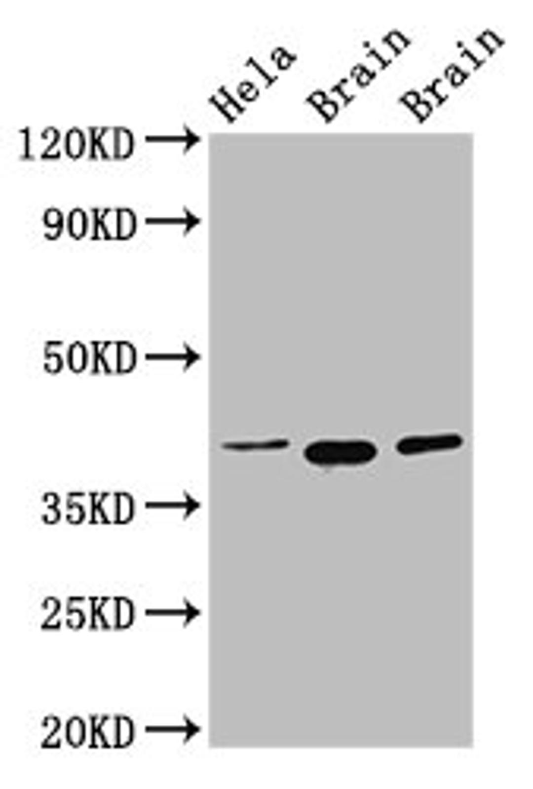 Western Blot. Positive WB detected in: Hela whole cell lysate, Rat brain tissue, Mouse brain tissue. All lanes: ERGIC2 antibody at 2.5µg/ml. Secondary. Goat polyclonal to rabbit IgG at 1/50000 dilution. Predicted band size: 43 kDa. Observed band size: 43 kDa
