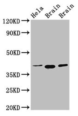 Western Blot. Positive WB detected in: Hela whole cell lysate, Rat brain tissue, Mouse brain tissue. All lanes: ERGIC2 antibody at 2.5µg/ml. Secondary. Goat polyclonal to rabbit IgG at 1/50000 dilution. Predicted band size: 43 kDa. Observed band size: 43 kDa