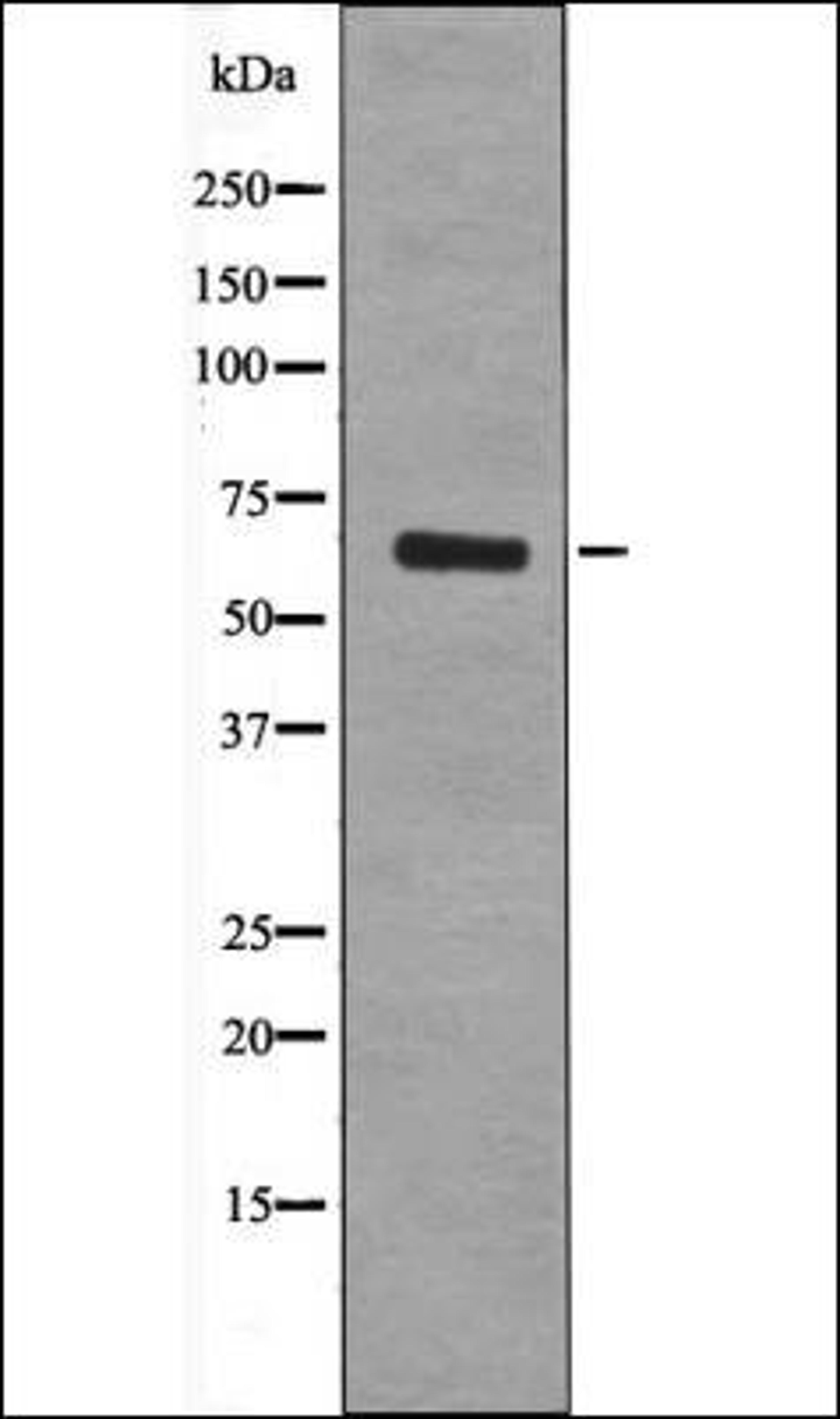 Western blot analysis of heatshock treated HT29 whole cell lysates using TGFBR2 -Phospho-Tyr284- antibody