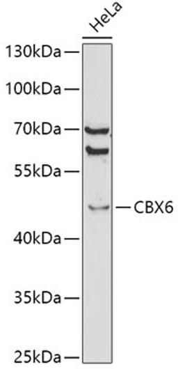 Western blot - CBX6 antibody (A5533)