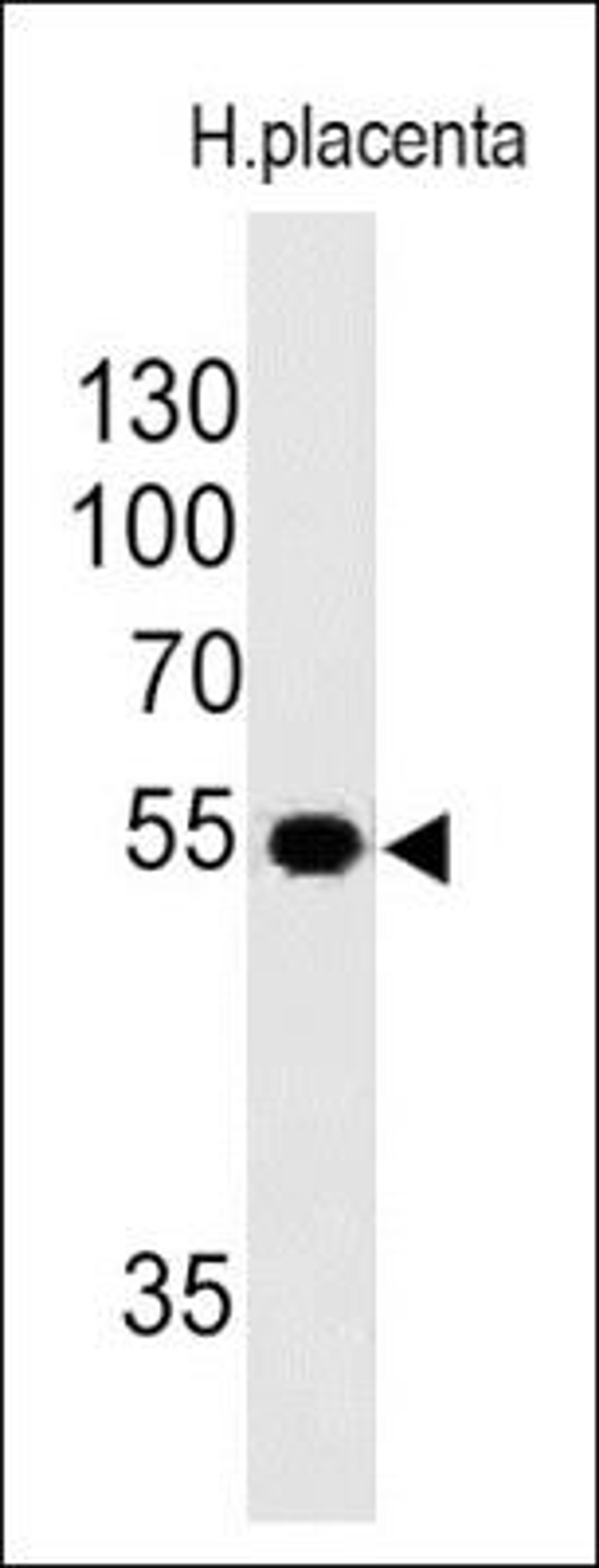 Western Blot: Ornithine Decarboxylase Antibody (SPM565) [NBP2-32888] - Analysis using the Azide and BSA Free version of NBP2-32888. Detection of ODC1 in human placental lysate